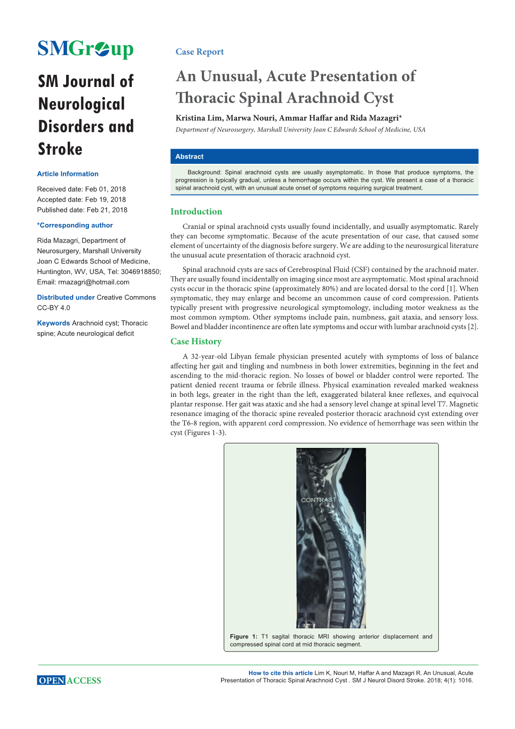 An Unusual, Acute Presentation of Thoracic Spinal Arachnoid Cyst