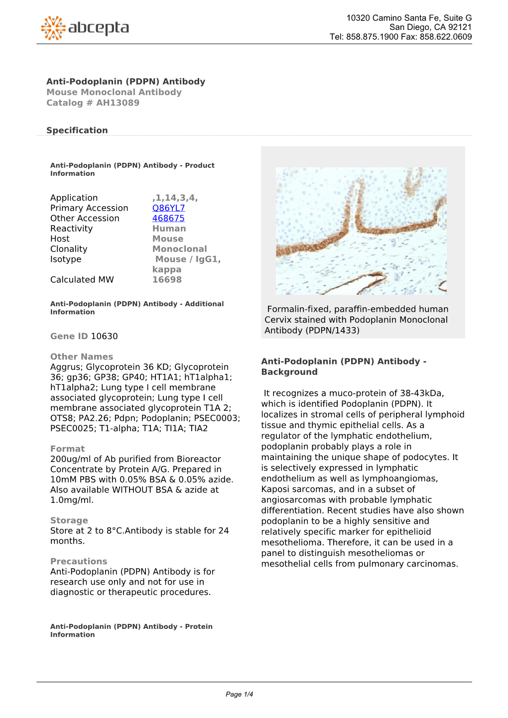 Anti-Podoplanin (PDPN) Antibody Mouse Monoclonal Antibody Catalog # AH13089