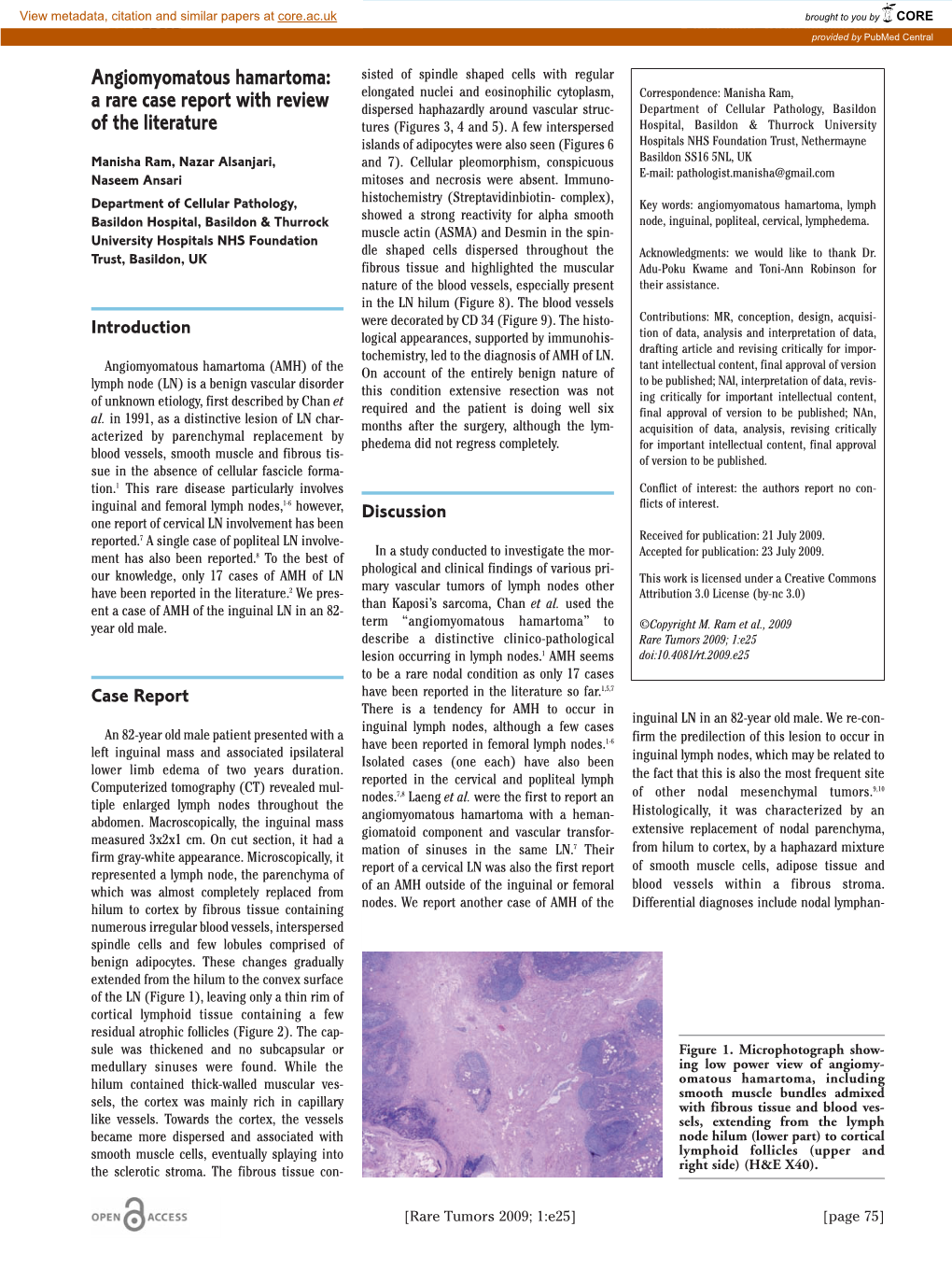 Angiomyomatous Hamartoma: a Rare Case Report with Review Of