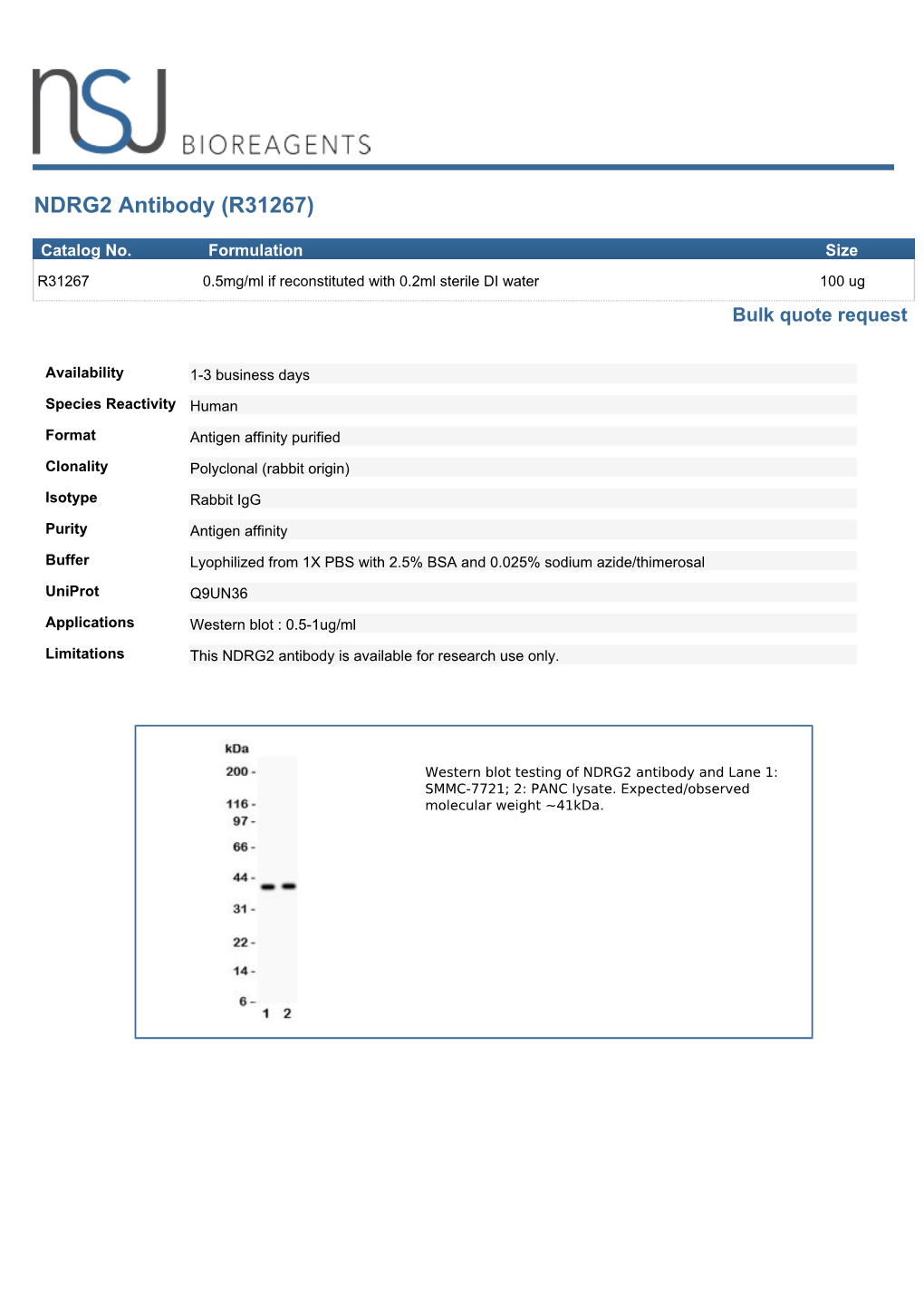 NDRG2 Antibody (R31267)