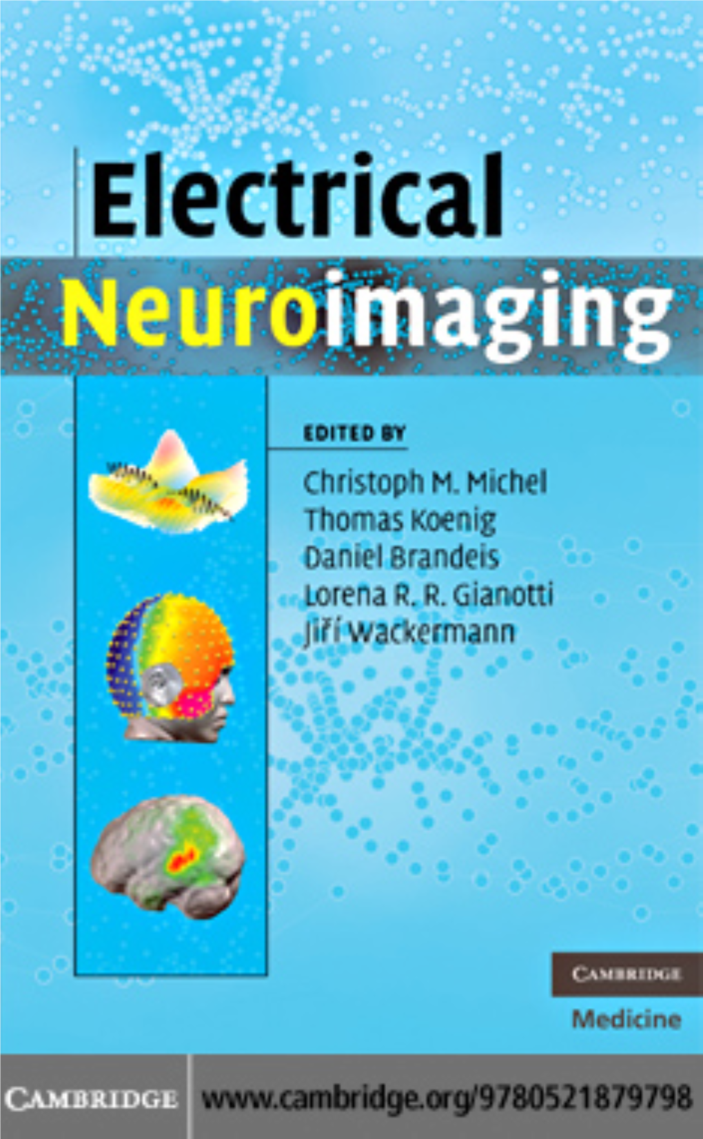 Electrical Neuroimaging