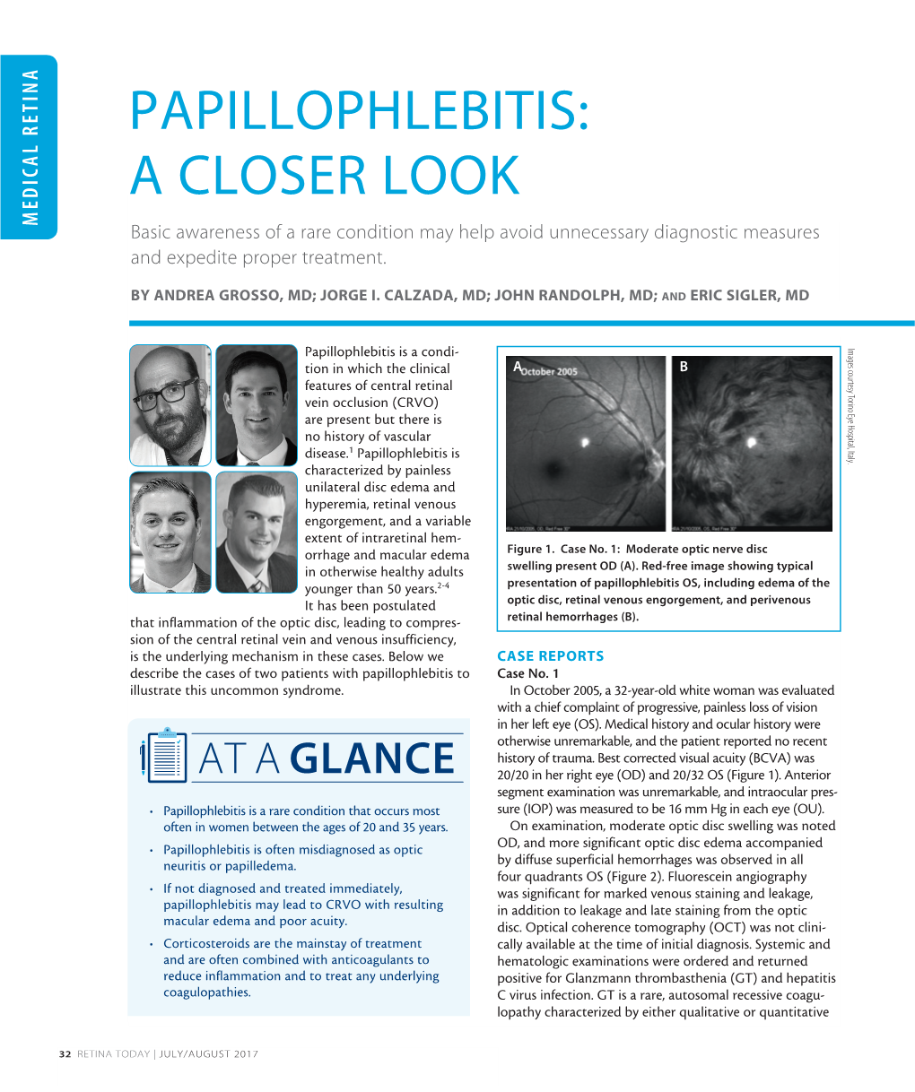 PAPILLOPHLEBITIS: Illustrate Illustrate This Uncommon Syndrome