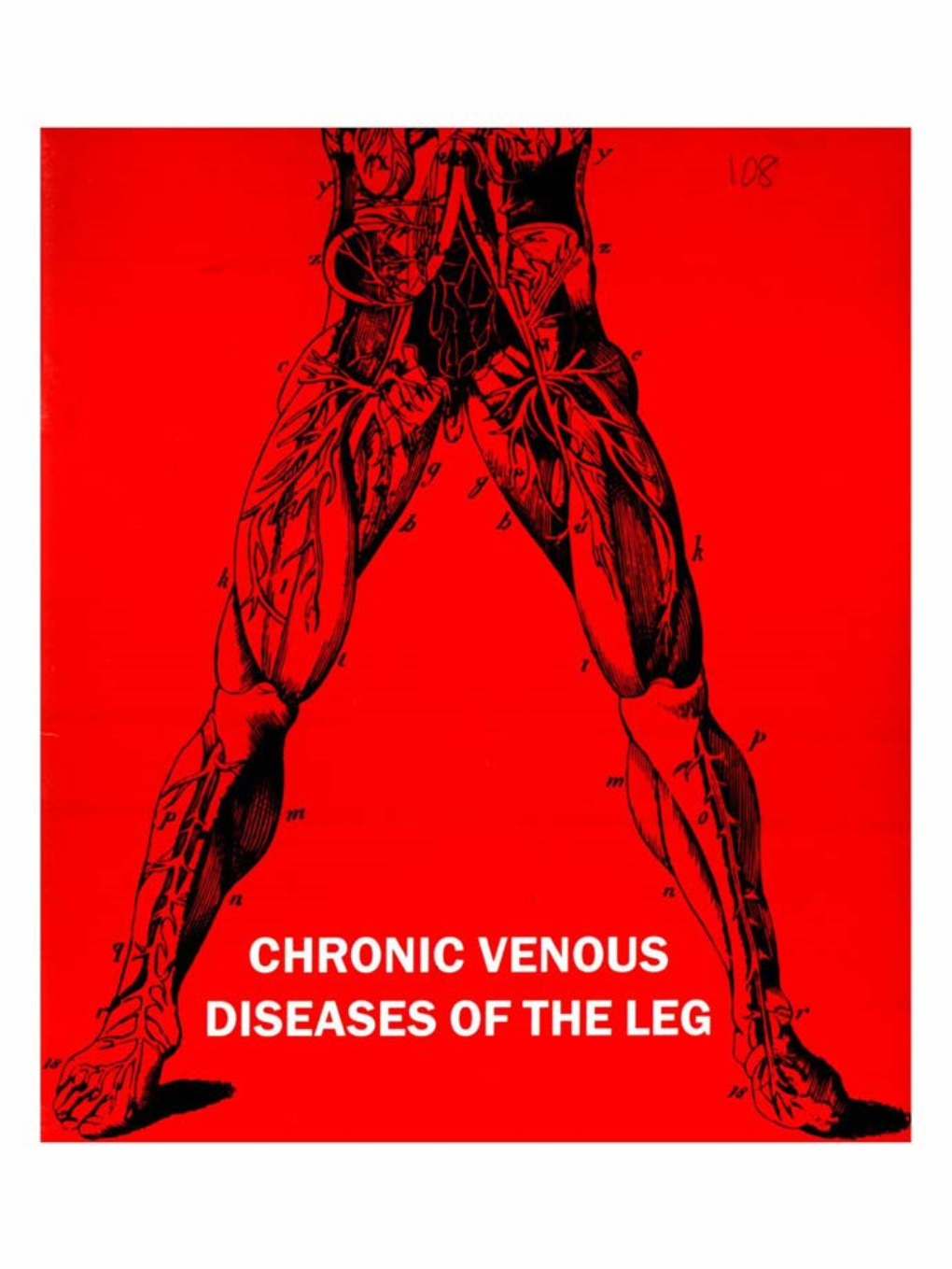 Chronic Venous Diseases of the Leg