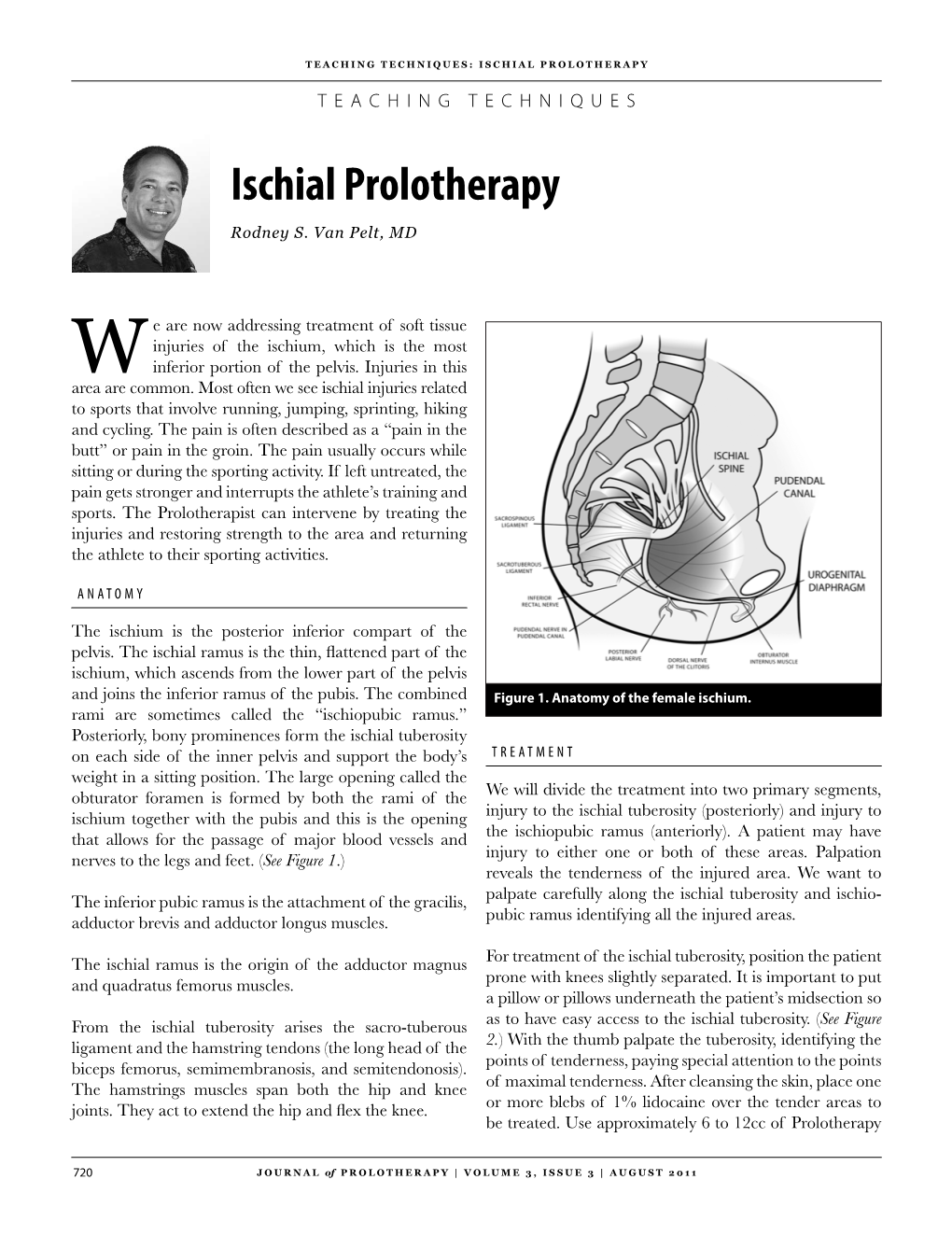 Ischial Prolotherapy