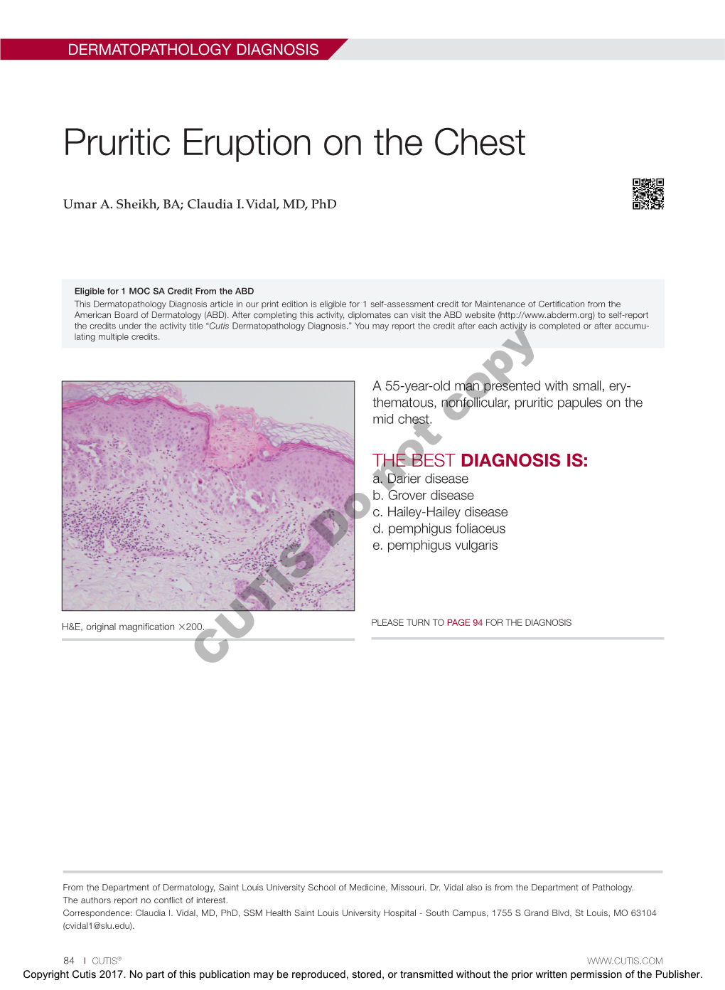 Pruritic Eruption on the Chest