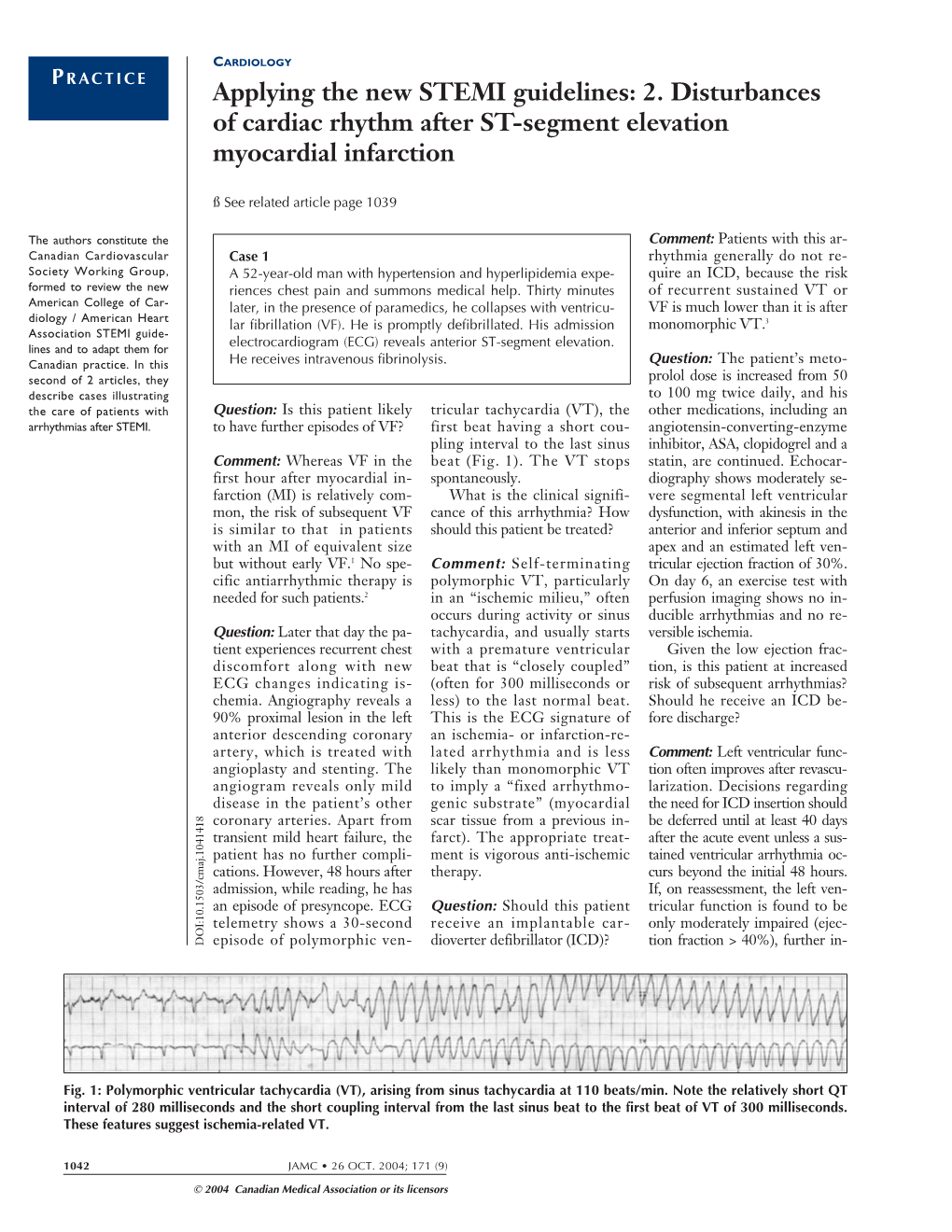 2. Disturbances of Cardiac Rhythm After ST-Segment Elevation Myocardial Infarction