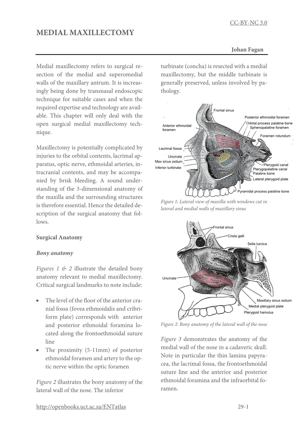 Medial Maxillectomy