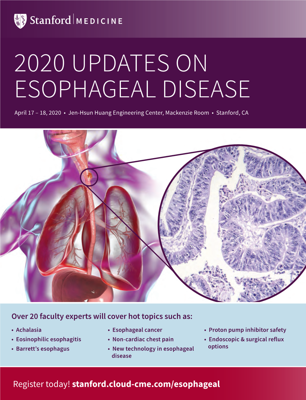 2020 UPDATES on ESOPHAGEAL DISEASE April 17 – 18, 2020 • Jen-Hsun Huang Engineering Center, Mackenzie Room • Stanford, CA REGISTRATION