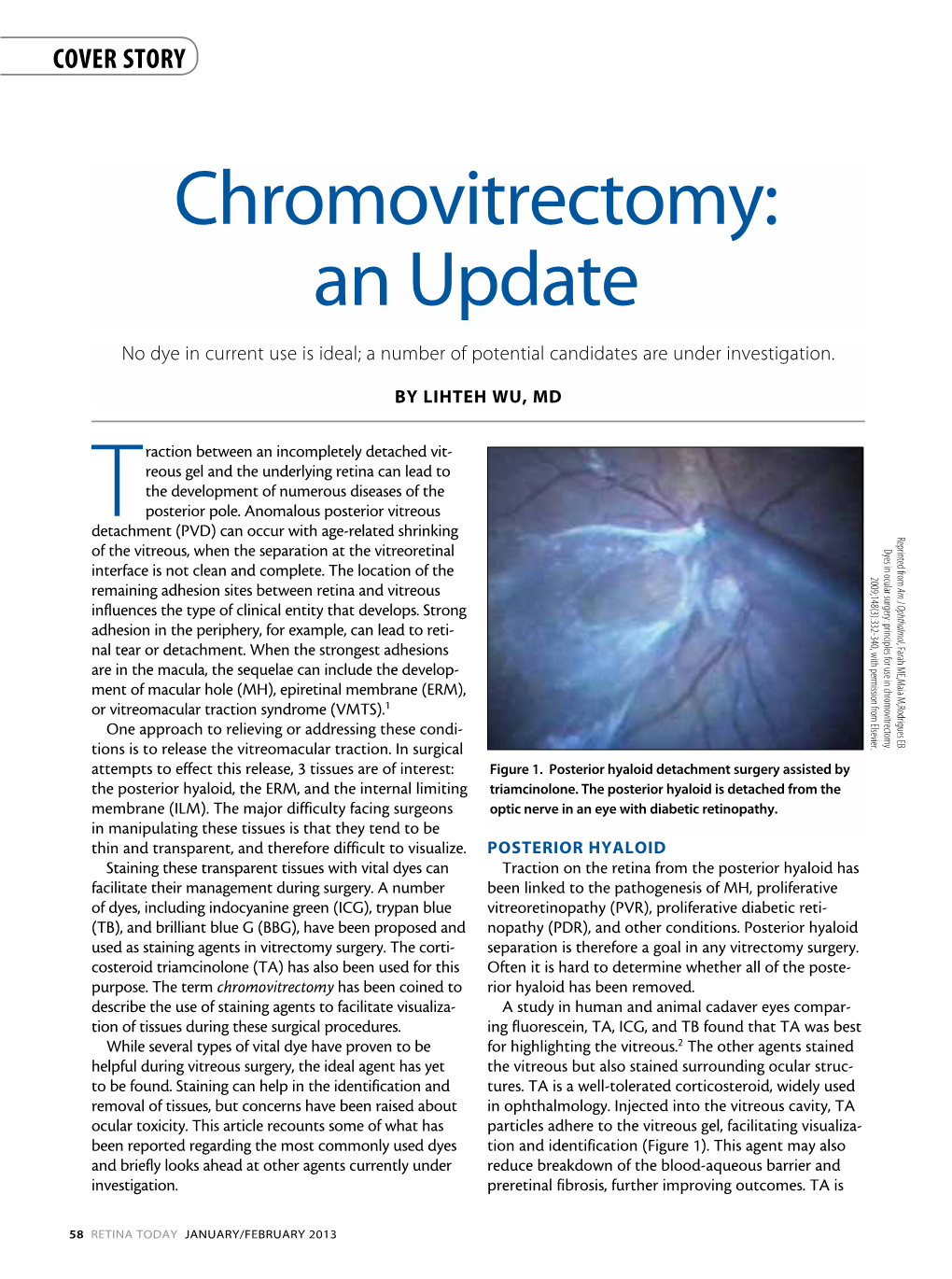 Chromovitrectomy: an Update