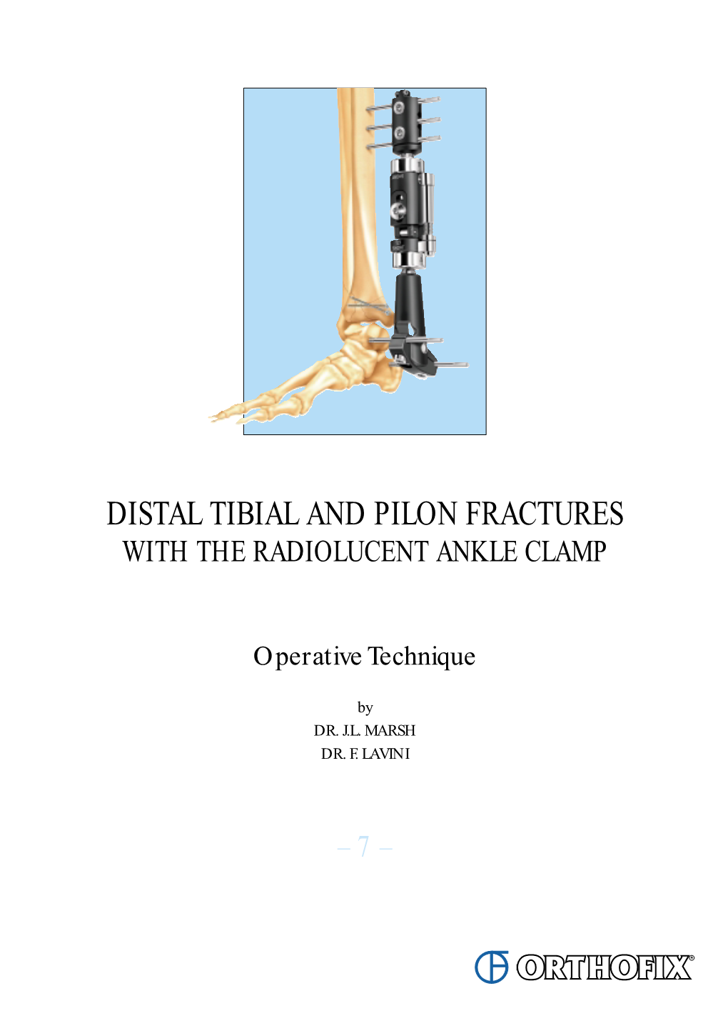 Distal Tibial and Pilon Fractures with the Radiolucent Ankle Clamp
