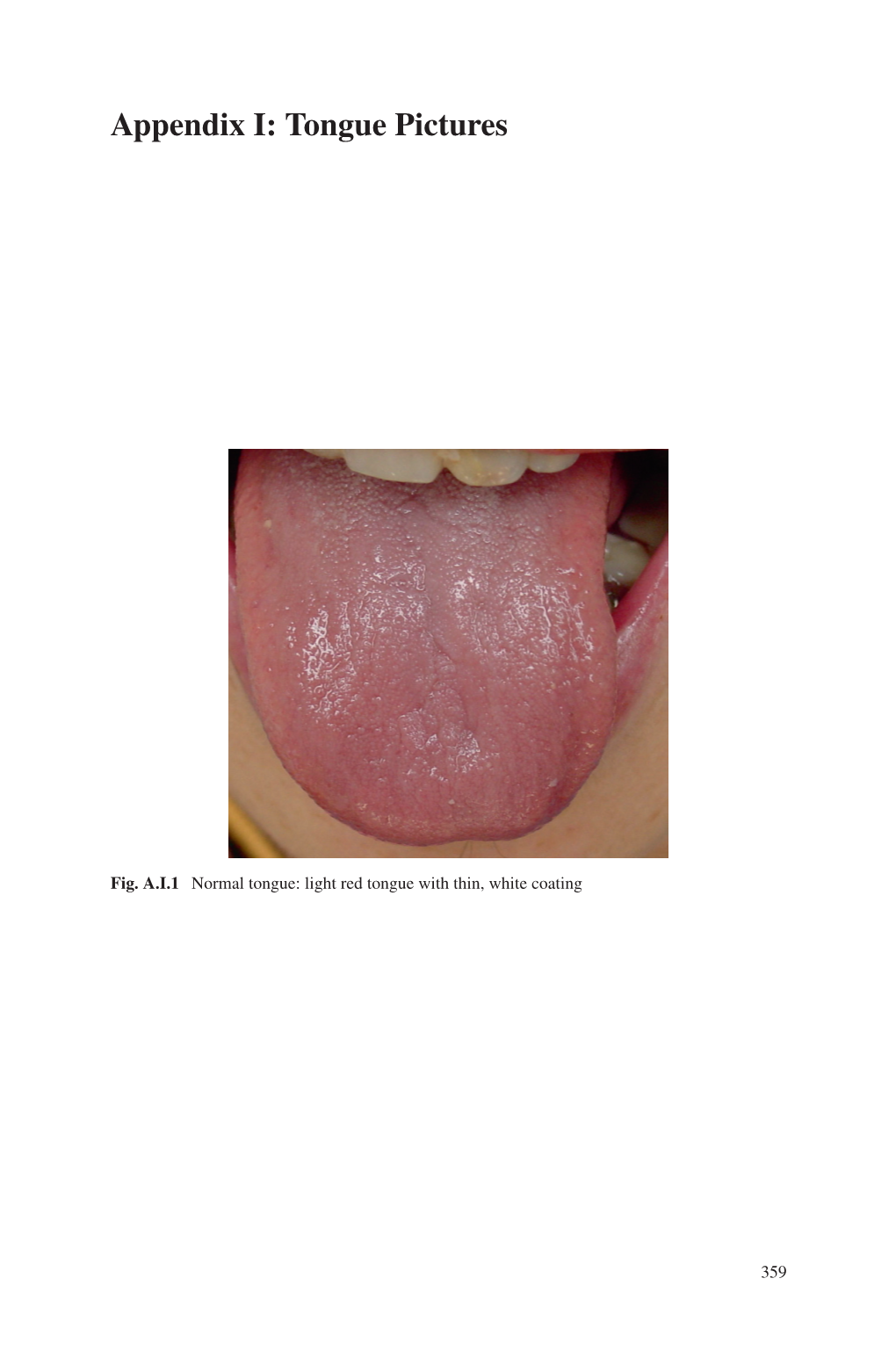 Appendix I: Tongue Pictures