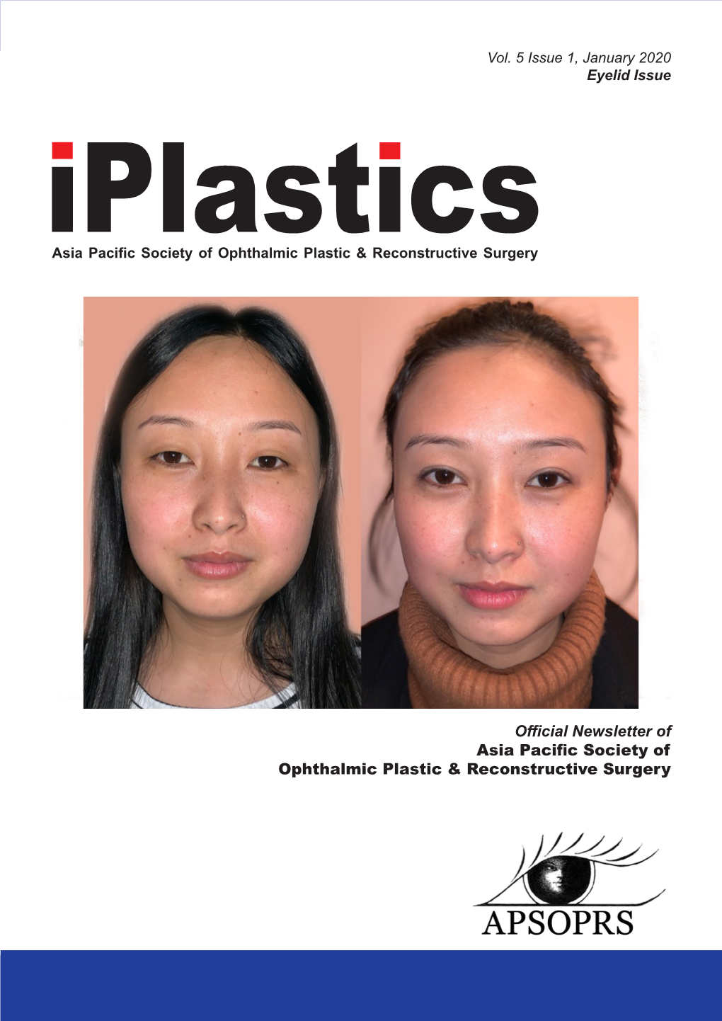 Official Newsletter of Asia Pacific Society of Ophthalmic Plastic & Reconstructive Surgery
