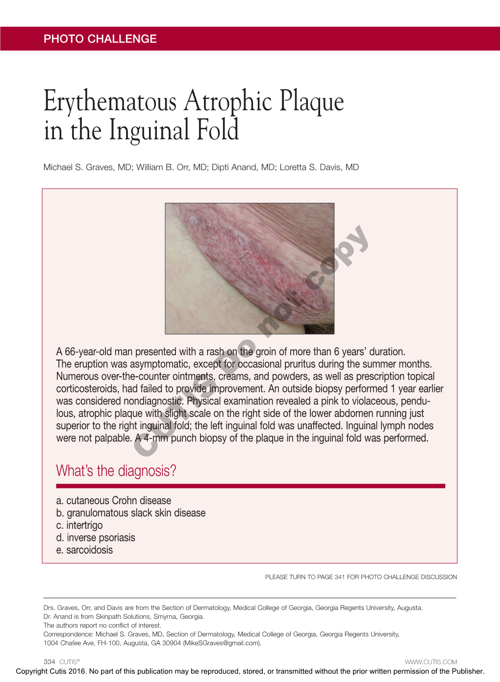 Erythematous Atrophic Plaque in the Inguinal Fold