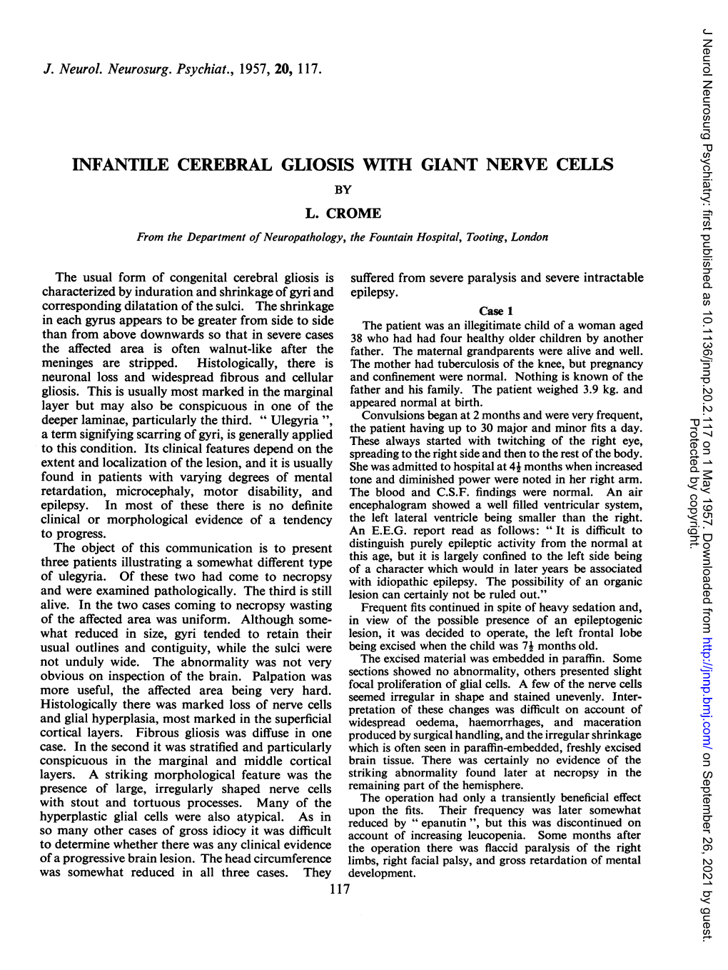 Infantile Cerebral Gliosis Wtith Giant Nerve Cells by L