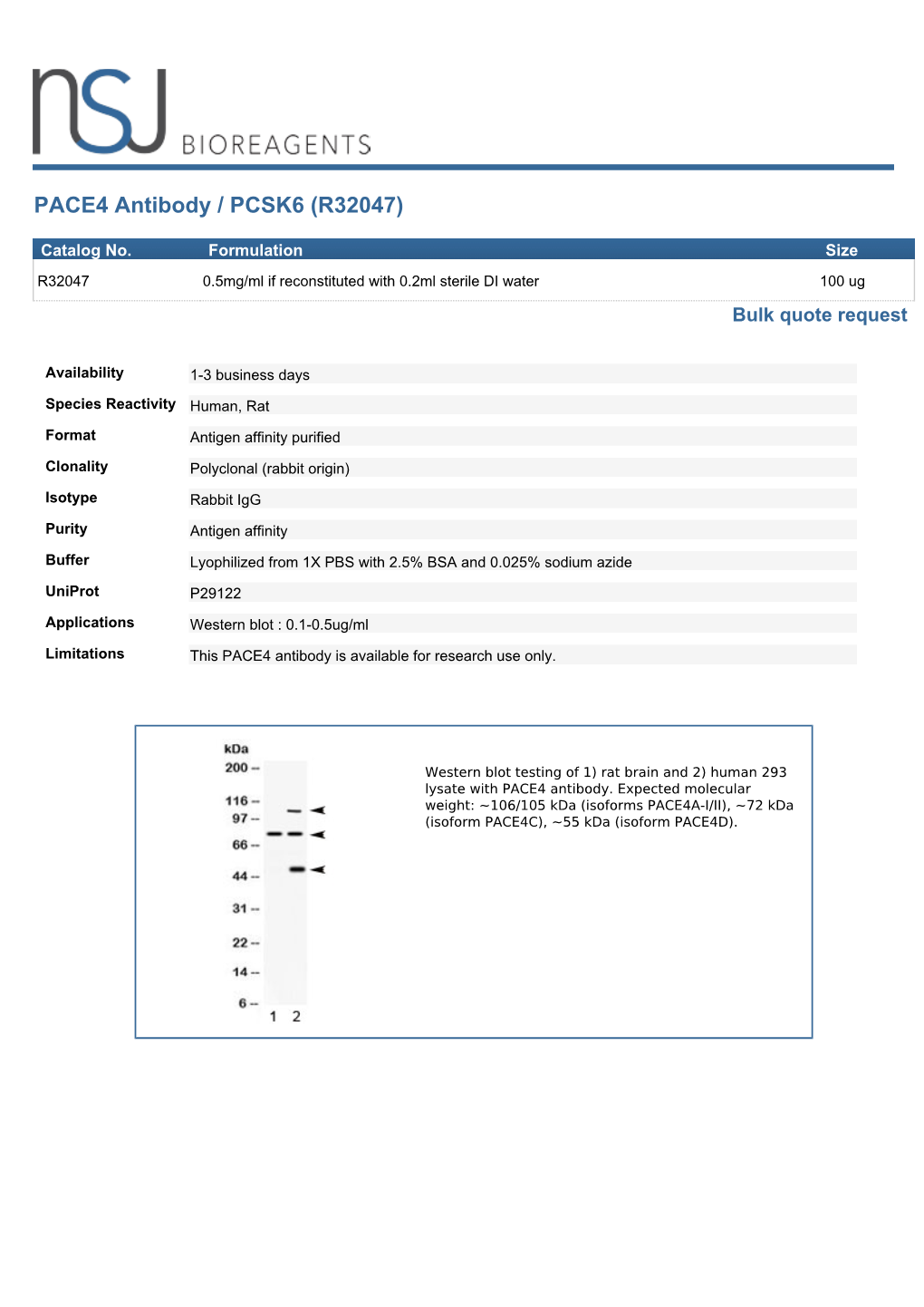 PACE4 Antibody / PCSK6 (R32047)