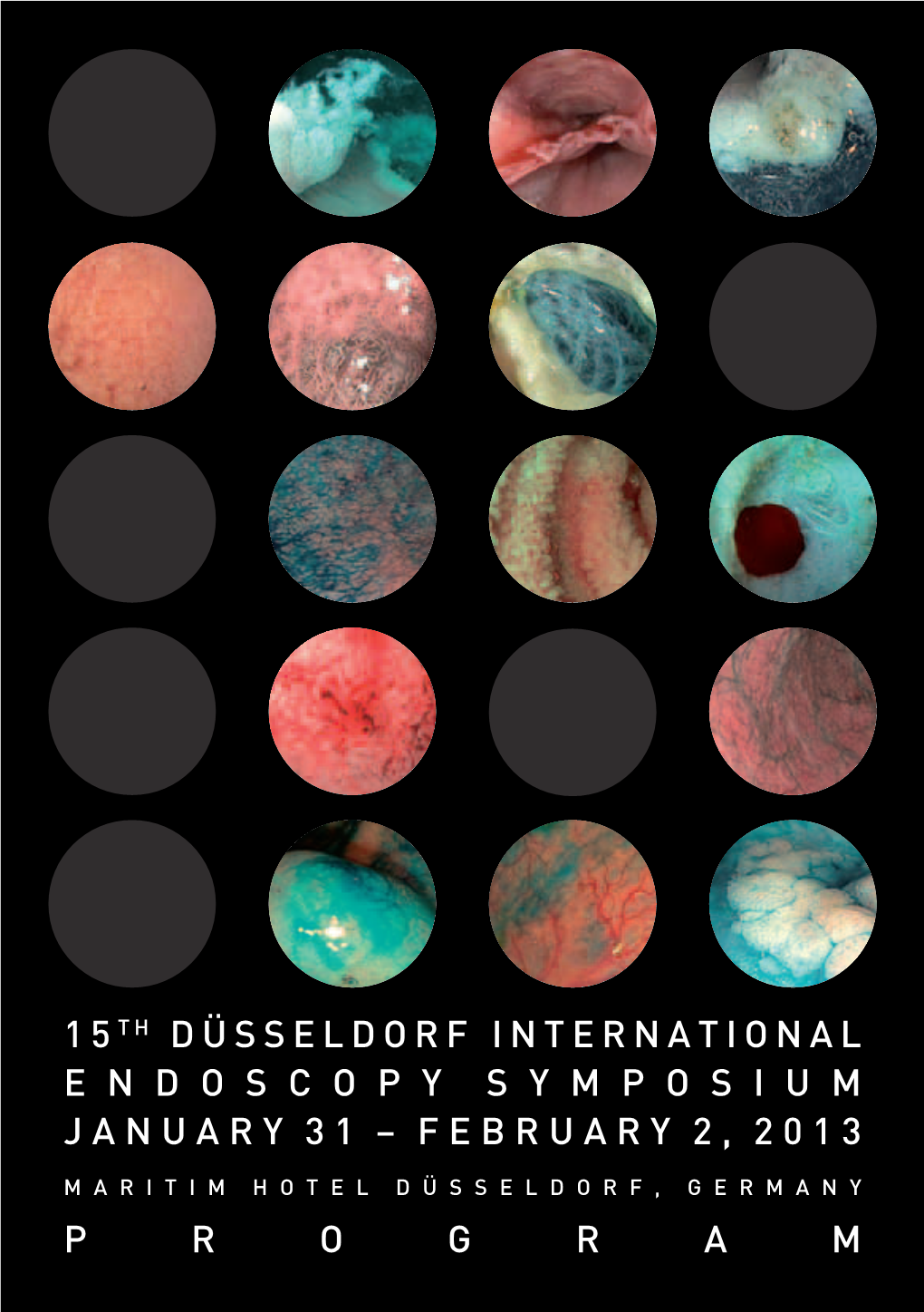 15Th Düsseldorf International Endoscopy Symposium January 31 – February 2, 2013