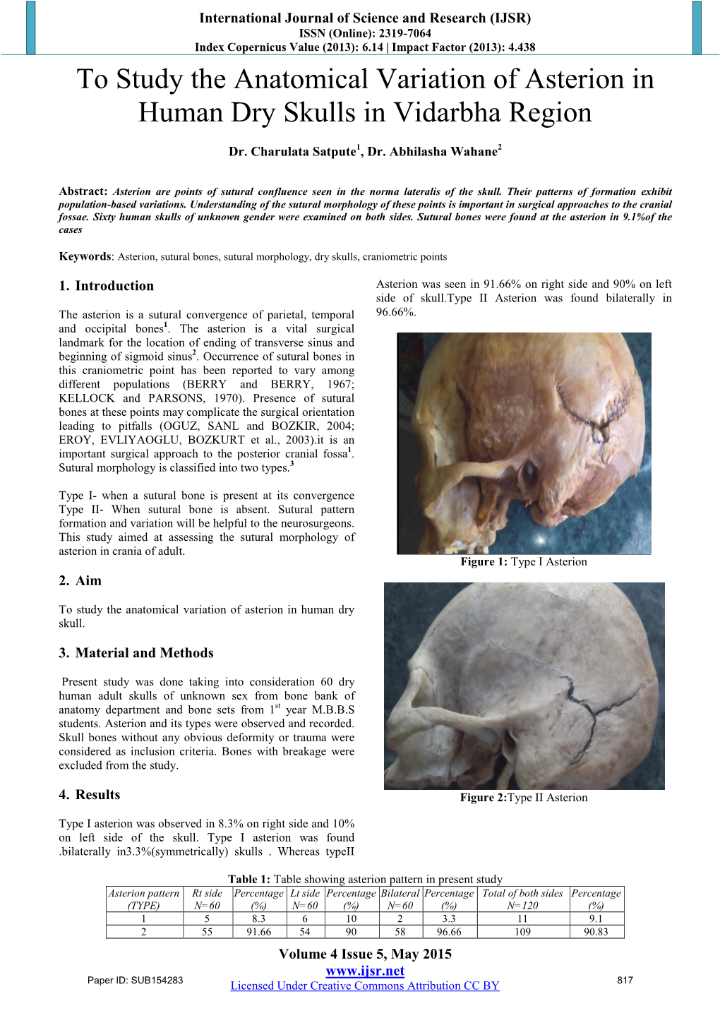 To Study the Anatomical Variation of Asterion in Human Dry Skulls in Vidarbha Region
