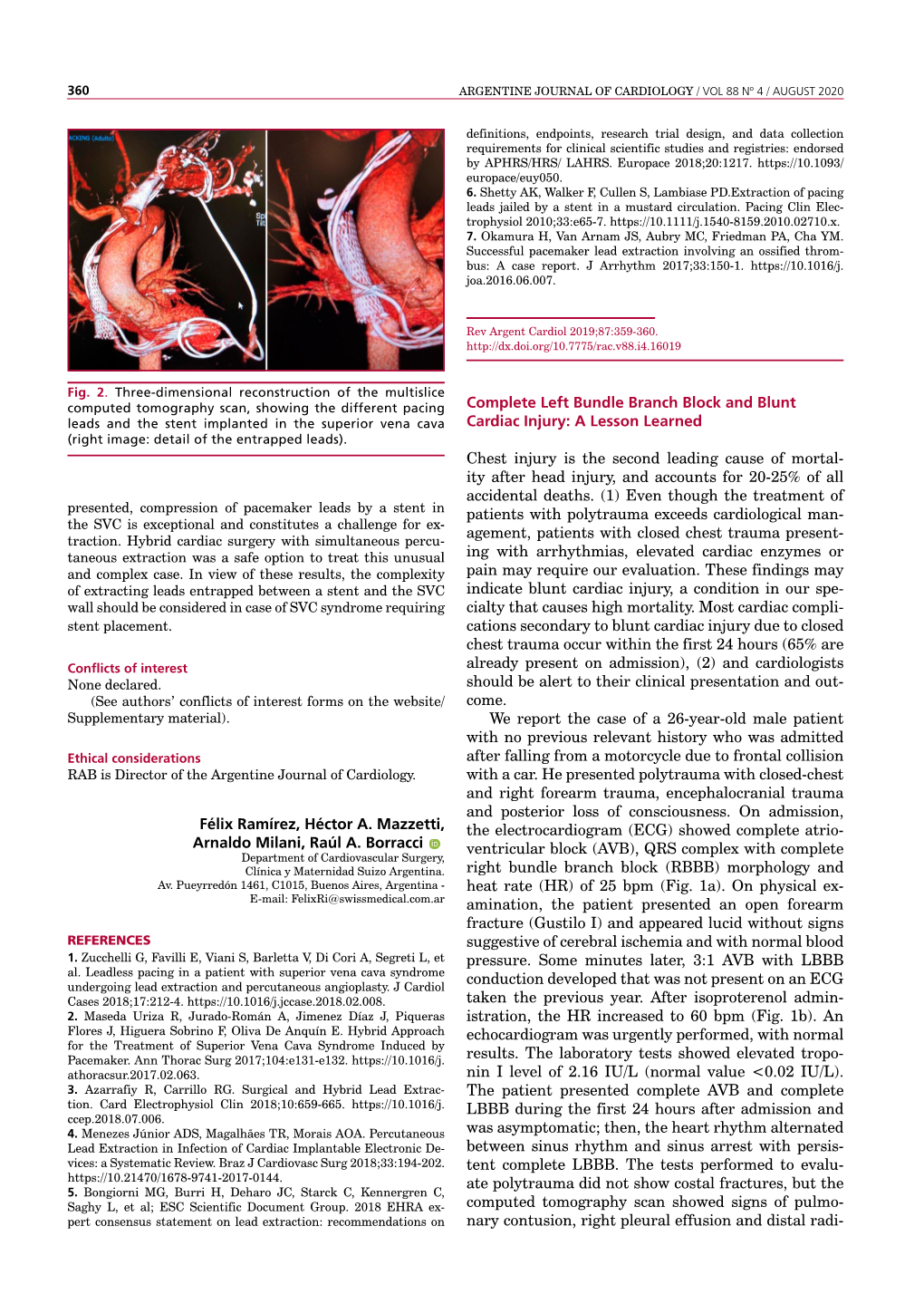 Complete Left Bundle Branch Block and Blunt Cardiac Injury