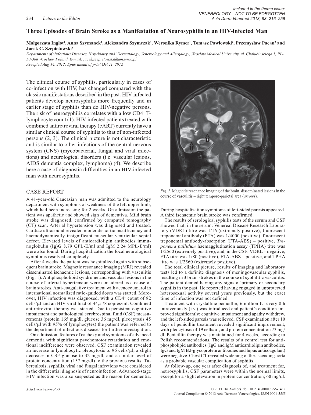 Three Episodes of Brain Stroke As a Manifestation of Neurosyphilis in an HIV-Infected Man