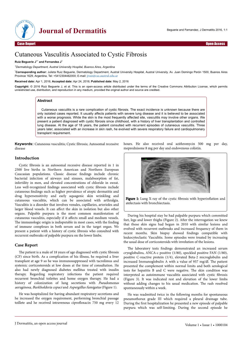 Cutaneous Vasculitis Associated to Cystic Fibrosis