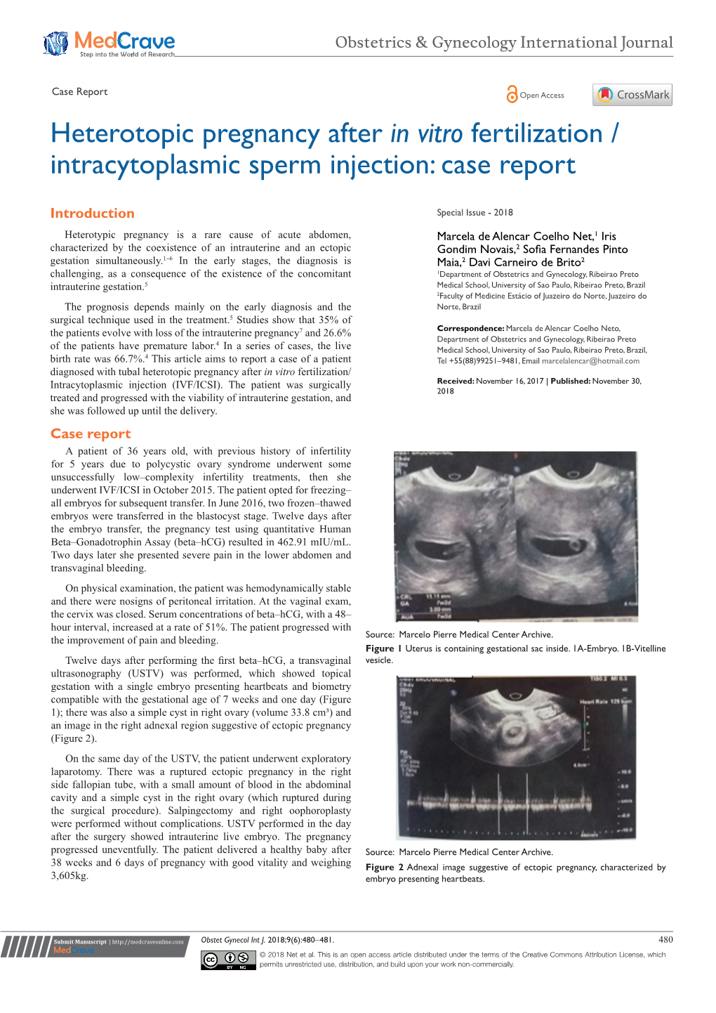 Heterotopic Pregnancy After in Vitro Fertilization / Intracytoplasmic Sperm Injection: Case Report