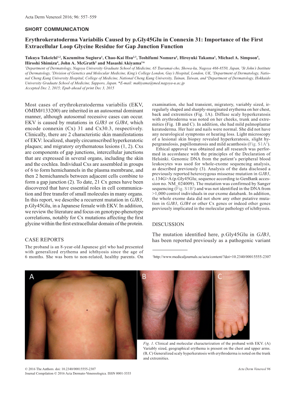 Erythrokeratoderma Variabilis Caused by P.Gly45glu in Connexin 31: Importance of the First Extracellular Loop Glycine Residue for Gap Junction Function