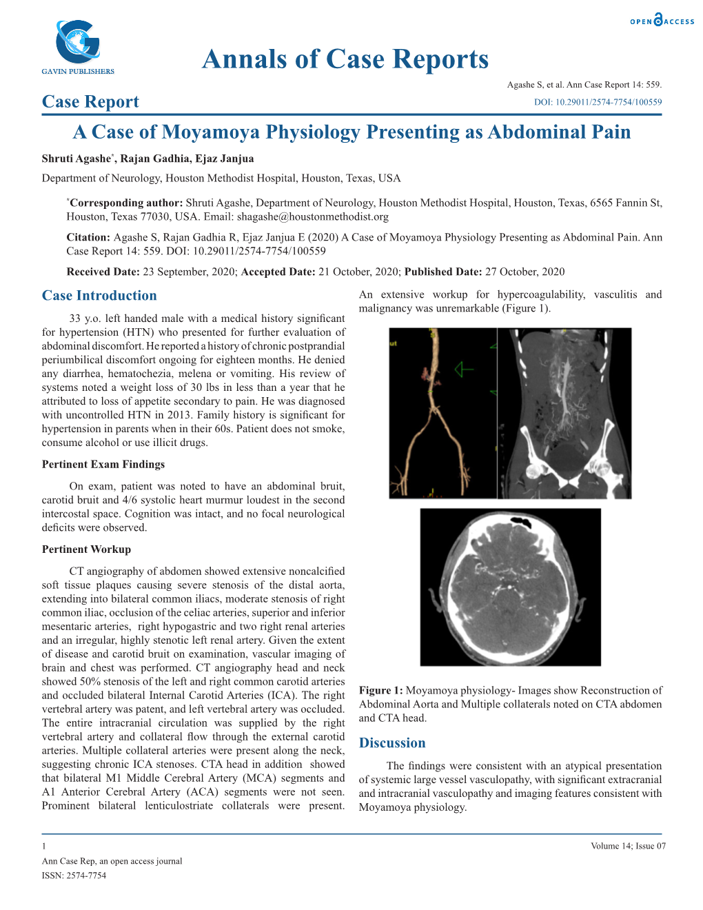 Annals of Case Reports Agashe S, Et Al