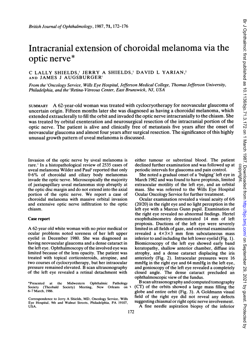 Intracranial Extension of Choroidal Melanoma Via the Optic Nerve*