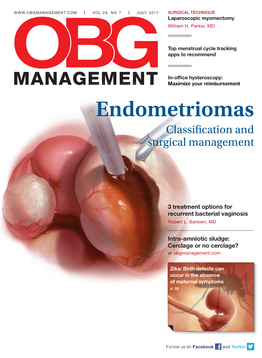 Endometriomasendometriomas Classificlassifi Catcationion a Nandd Surgicalsurgical Mamanagementnagement