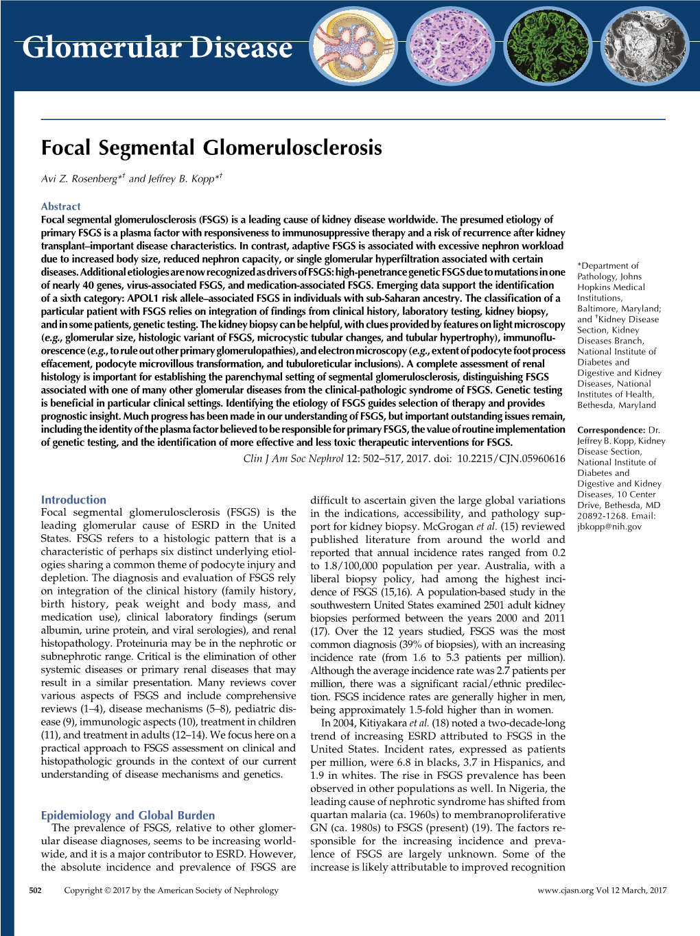 Focal Segmental Glomerulosclerosis