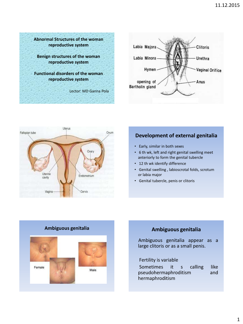 Abnormal Structures of the Woman Reproductive System