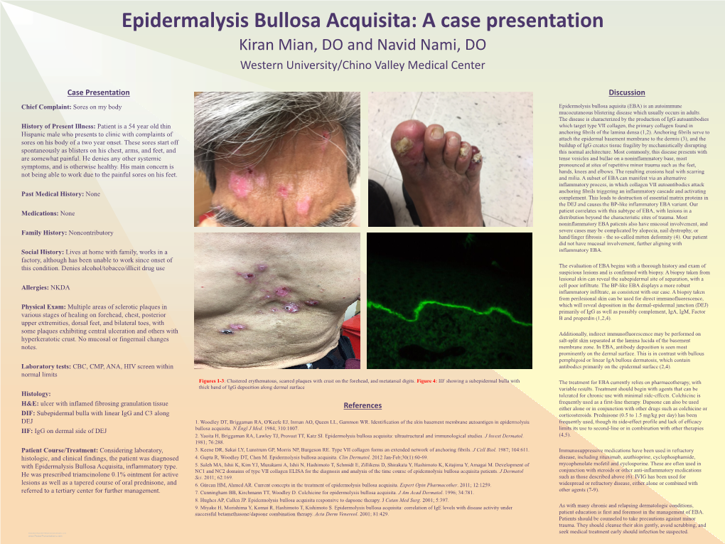 Epidermalysis Bullosa Acquisita: a Case Presentation Kiran Mian, DO and Navid Nami, DO Western University/Chino Valley Medical Center