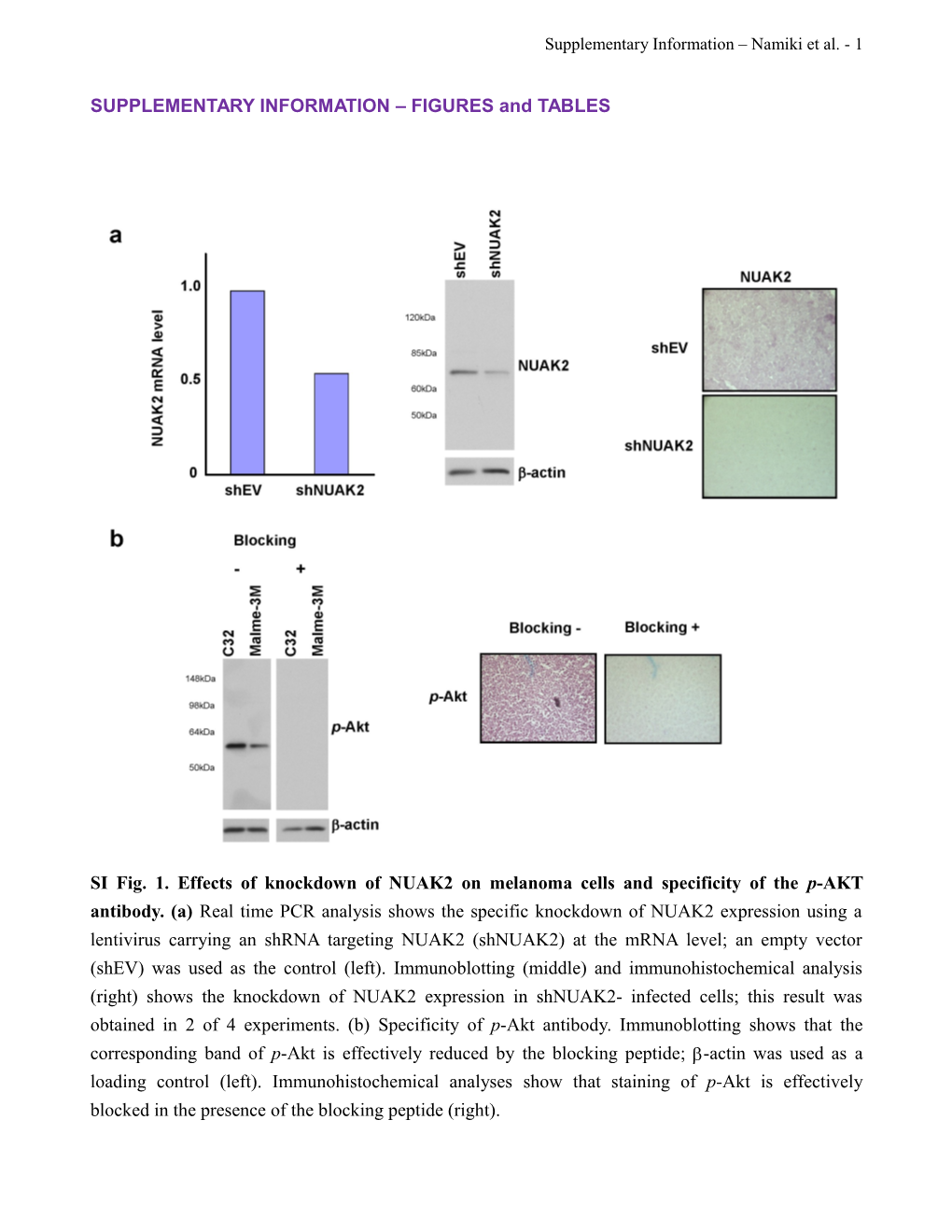 Chromosomal Imbalances in Primary Cutaneous Melanoma at Early and Advanced Stages Detected