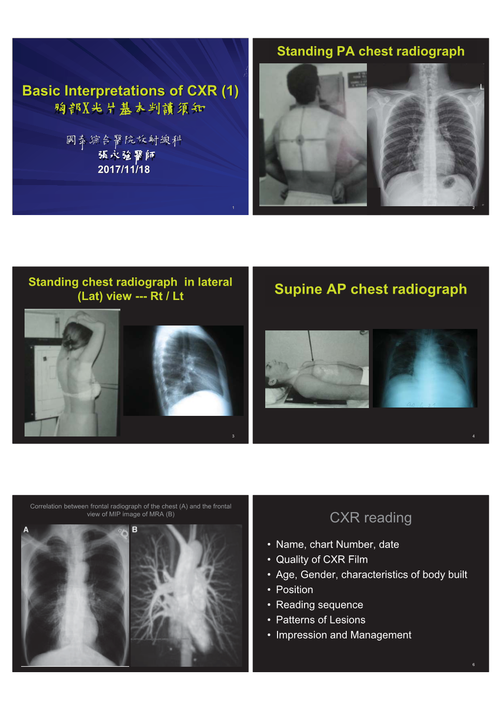 Basic Interpretation of CXR 胸部X-光片的基本判讀須知