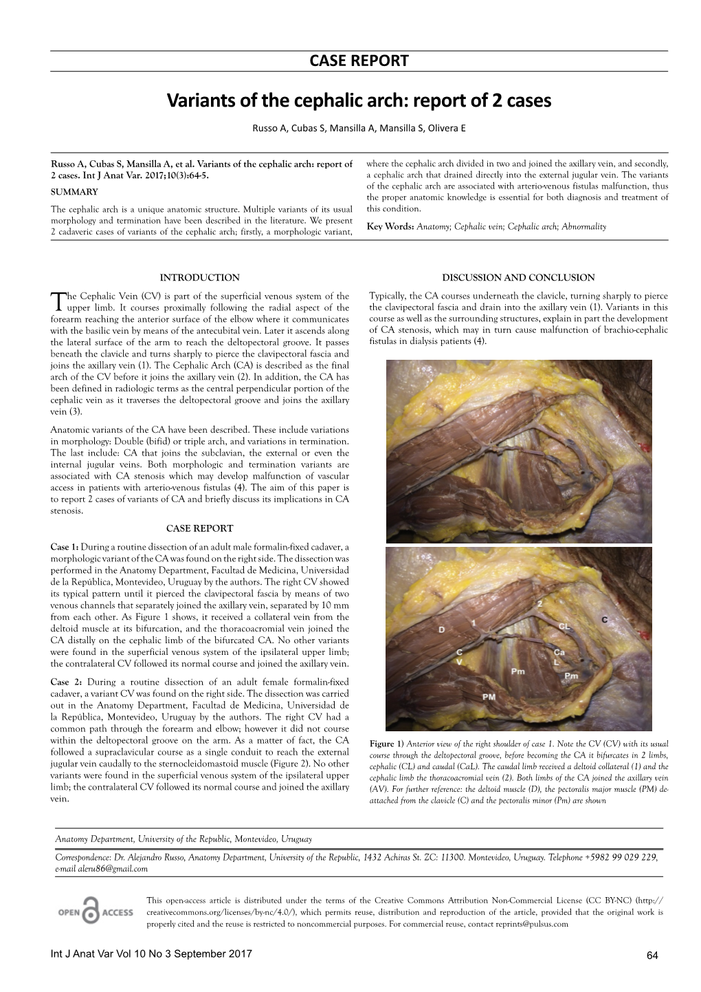 Variants of the Cephalic Arch: Report of 2 Cases