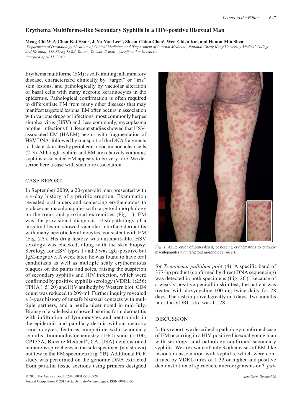 Erythema Multiforme-Like Secondary Syphilis in a HIV-Positive Bisexual Man