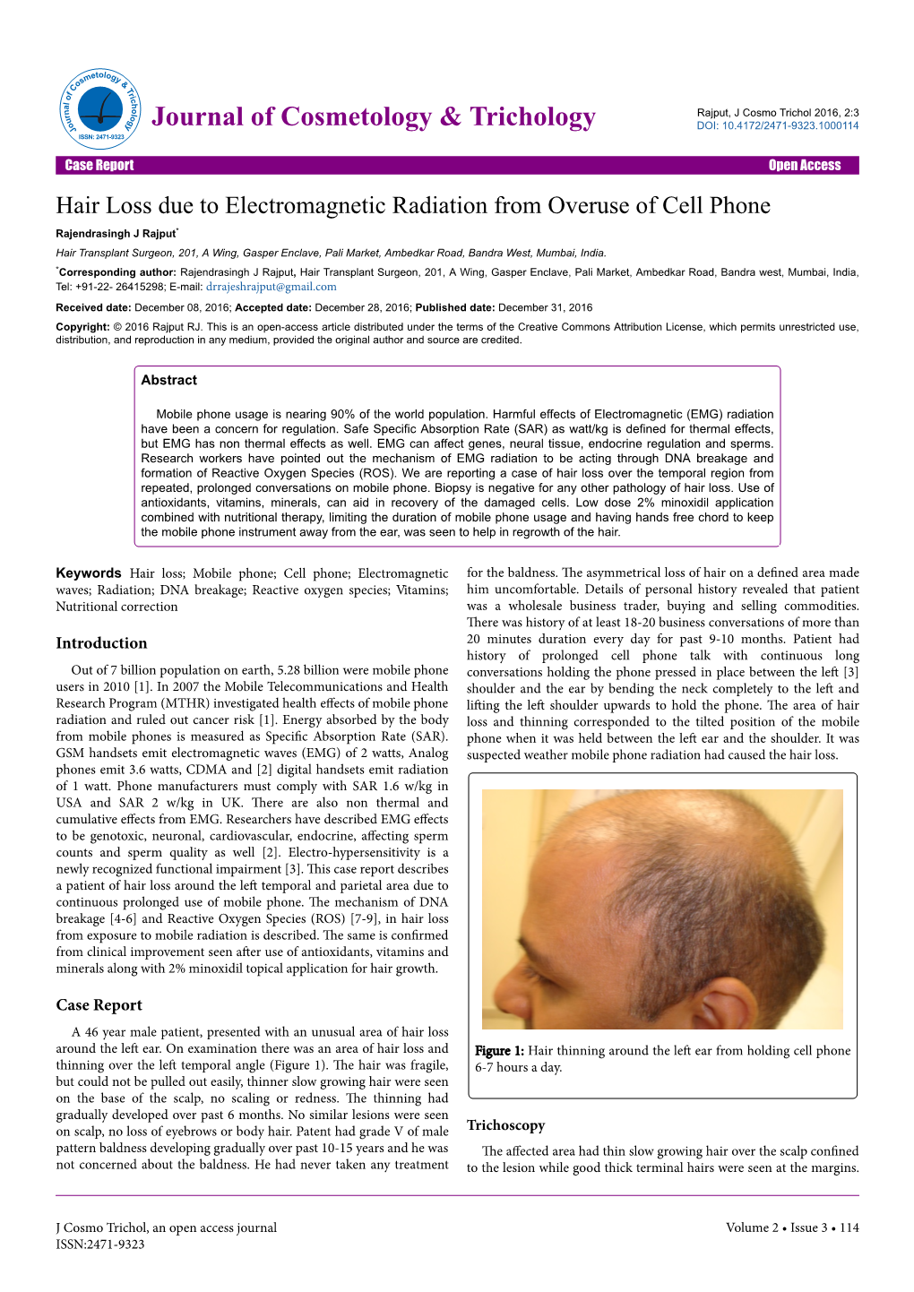 Hair Loss Due to Electromagnetic Radiation from Overuse of Cell Phone