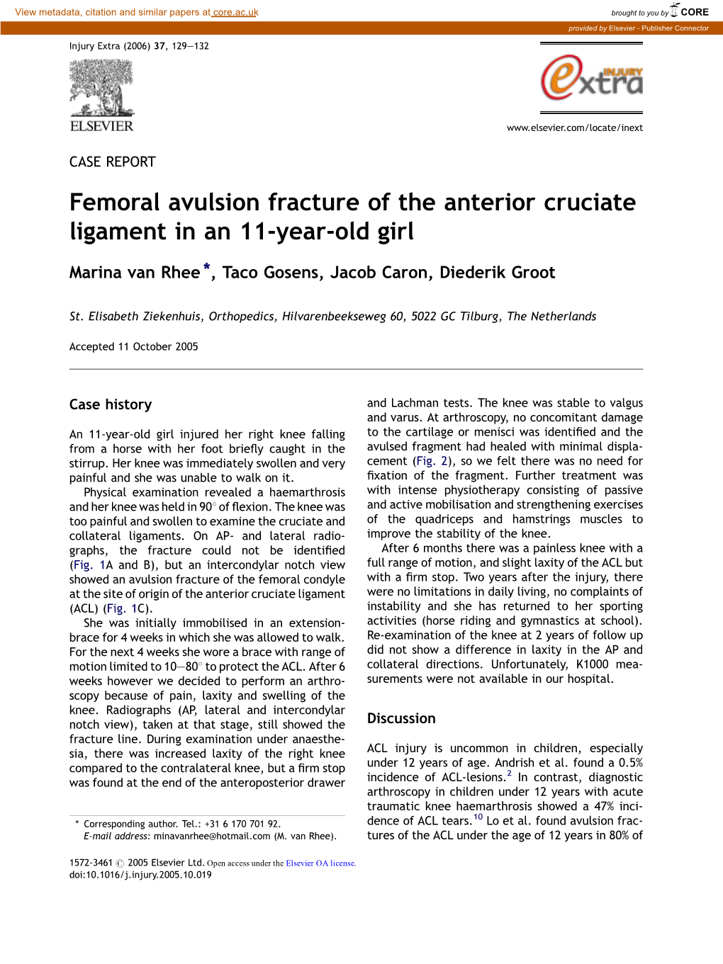 Femoral Avulsion Fracture of the Anterior Cruciate Ligament in an 11-Year-Old Girl