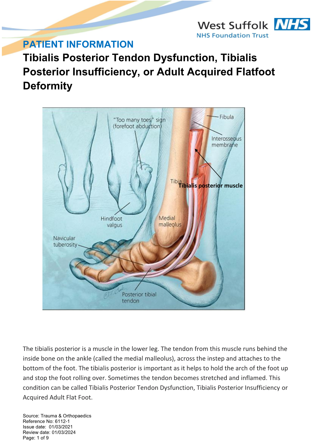 Tibialis Posterior Tendon Dysfunction Or Insufficiency Or Adult Acquired Flat