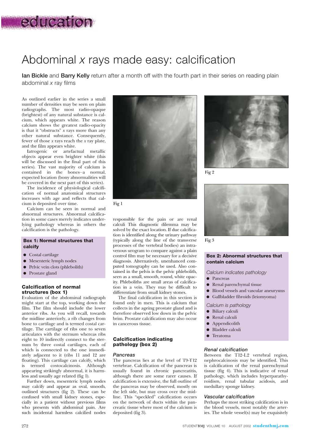 Abdominal X Rays Made Easy: Calcification