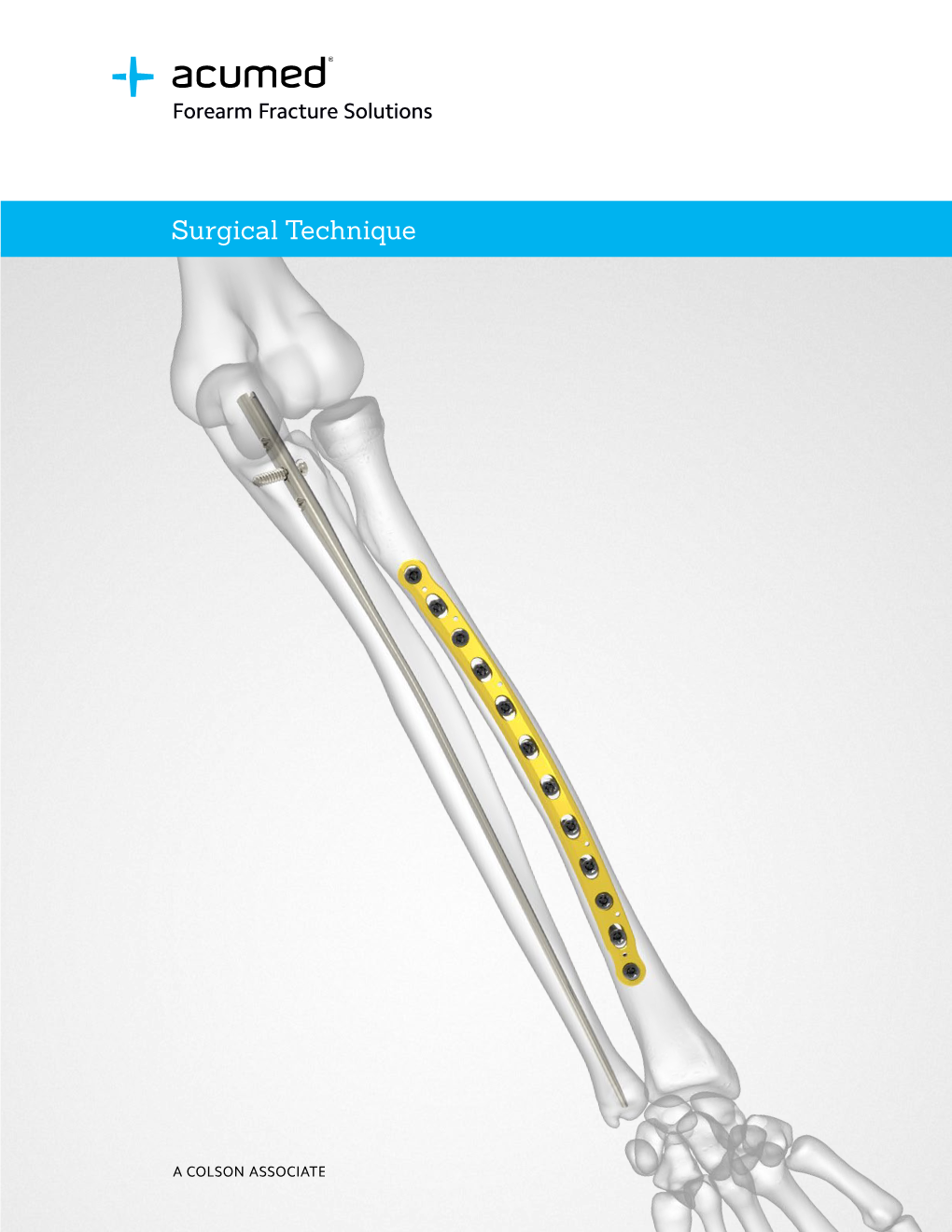 Forearm Fracture Solutions