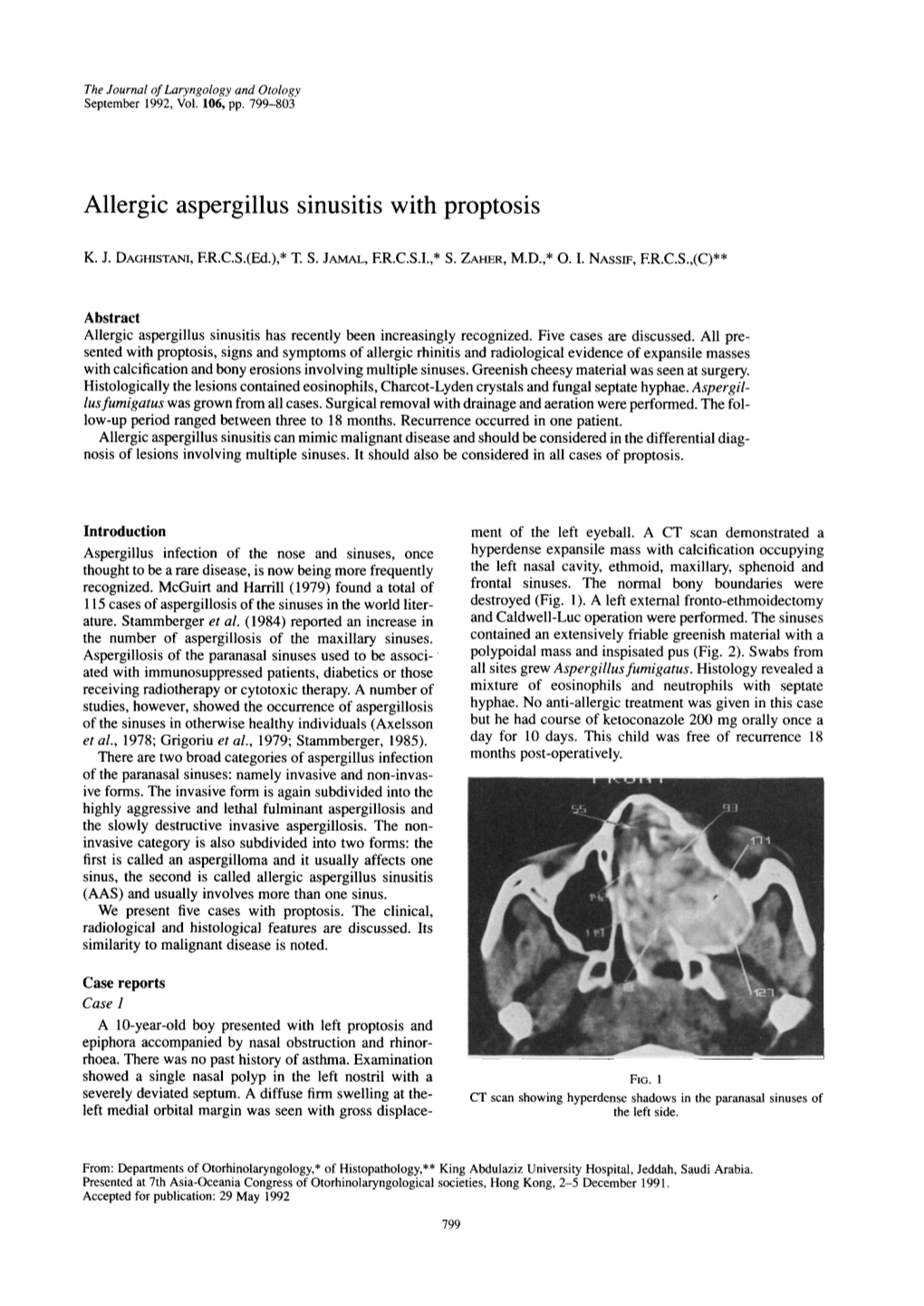 Allergic Aspergillus Sinusitis with Proptosis