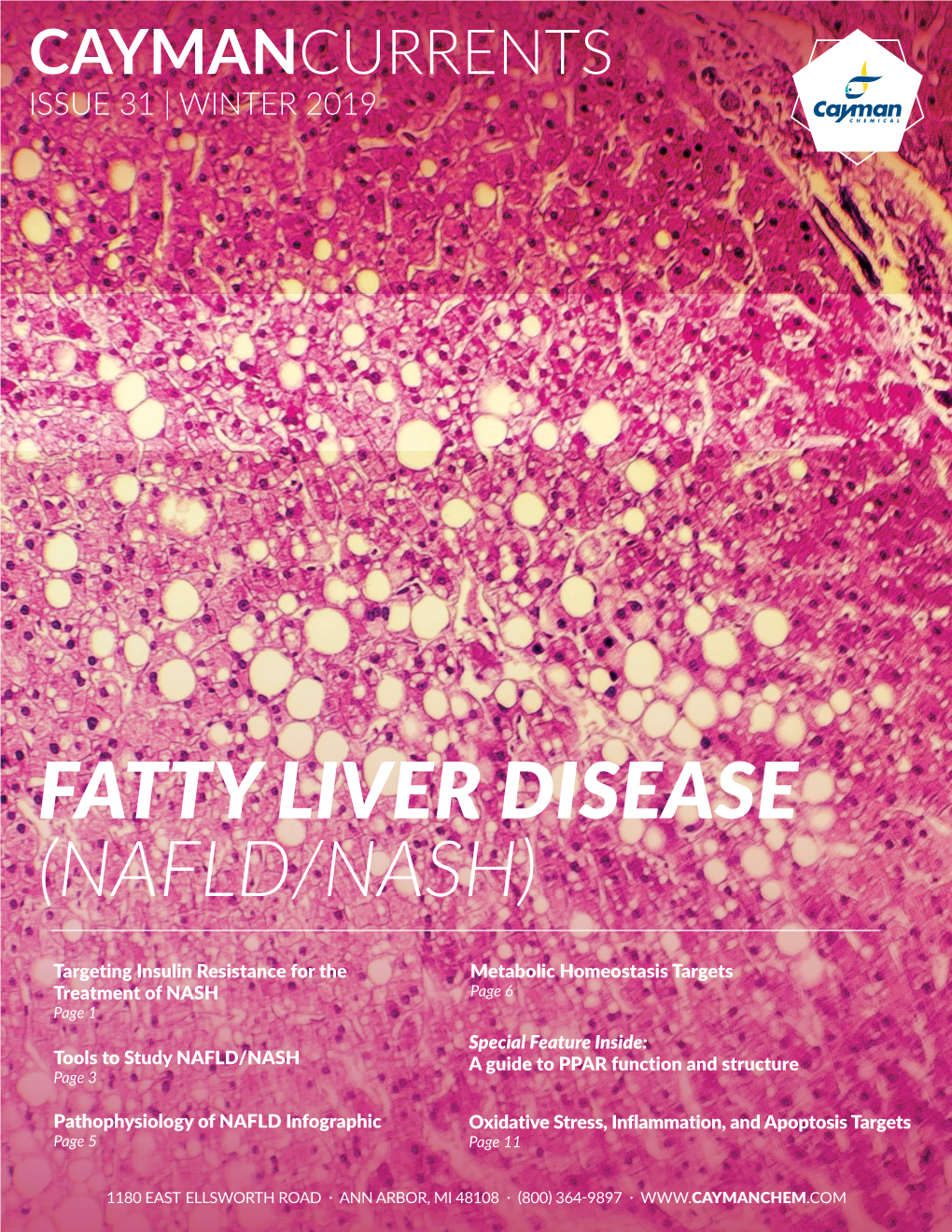 Fatty Liver Disease (Nafld/Nash)