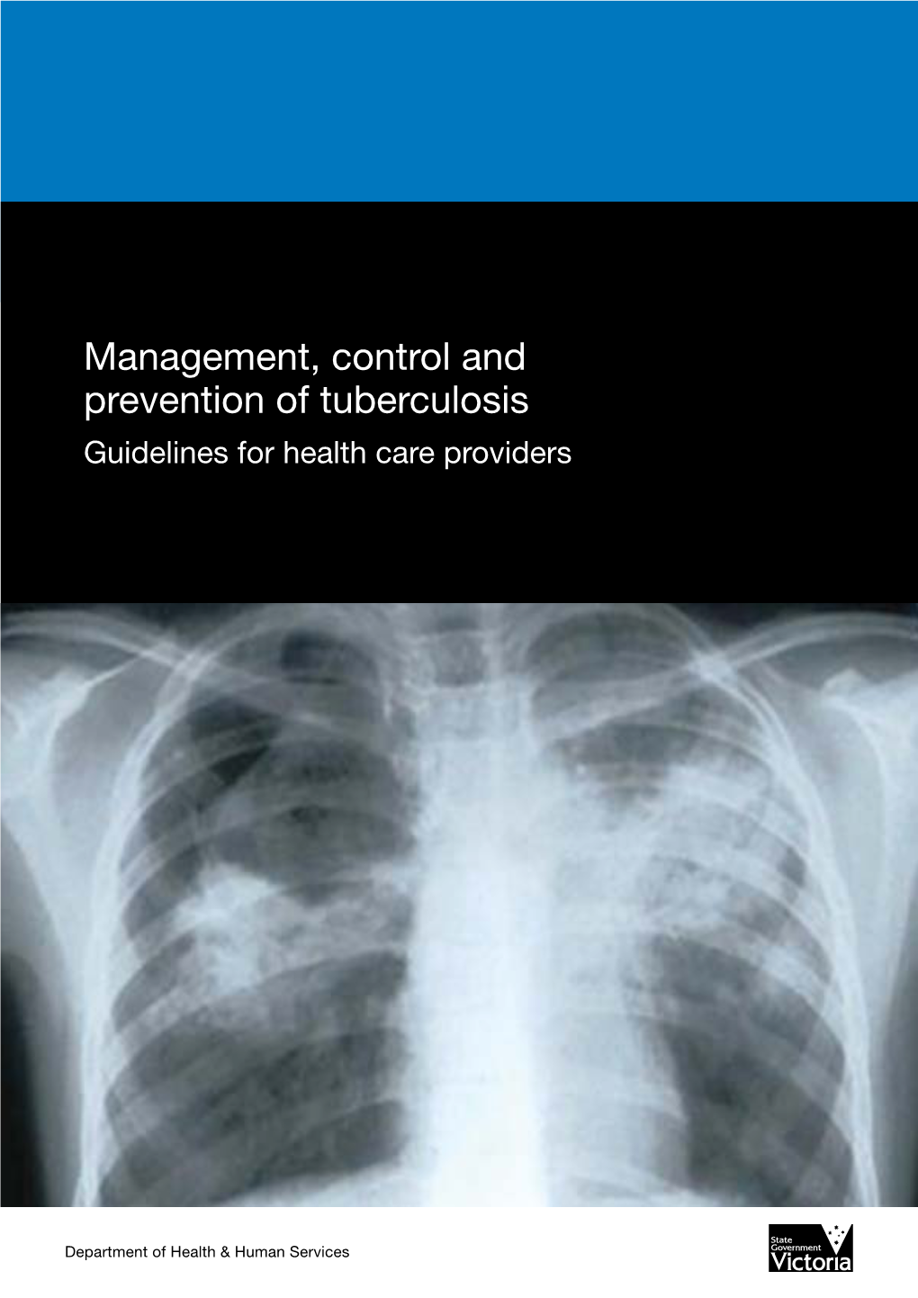 Management, Control and Prevention of Tuberculosis Guidelines for Health Care Providers