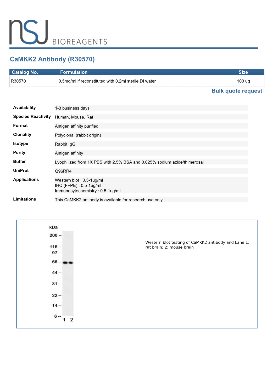 Camkk2 Antibody (R30570)