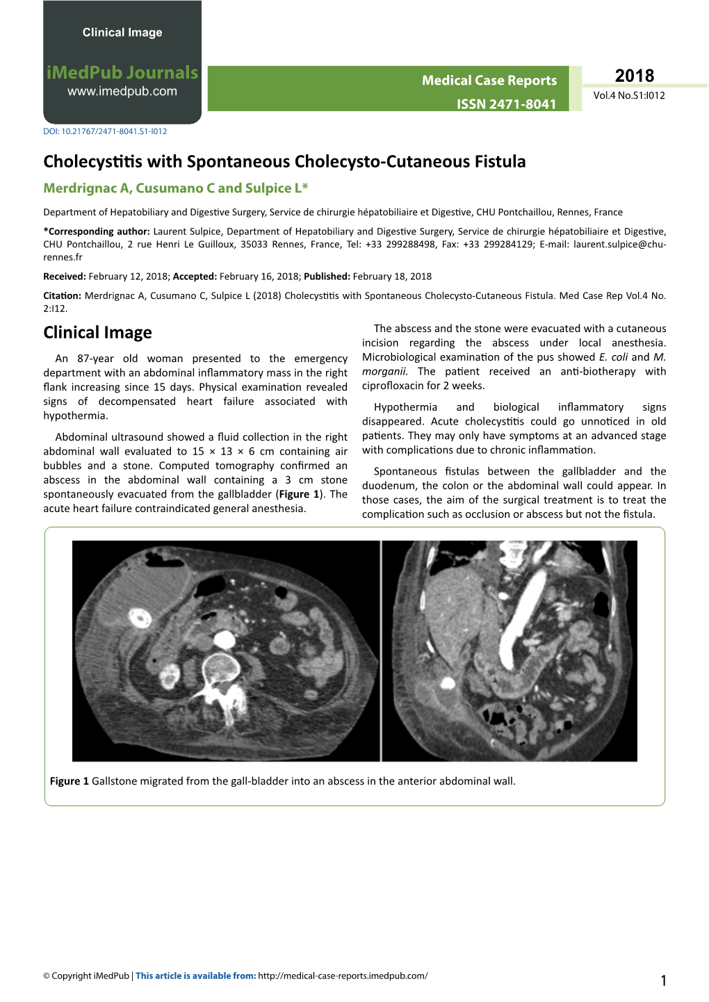 Cholecystitis with Spontaneous Cholecysto-Cutaneous Fistula Merdrignac A, Cusumano C and Sulpice L*