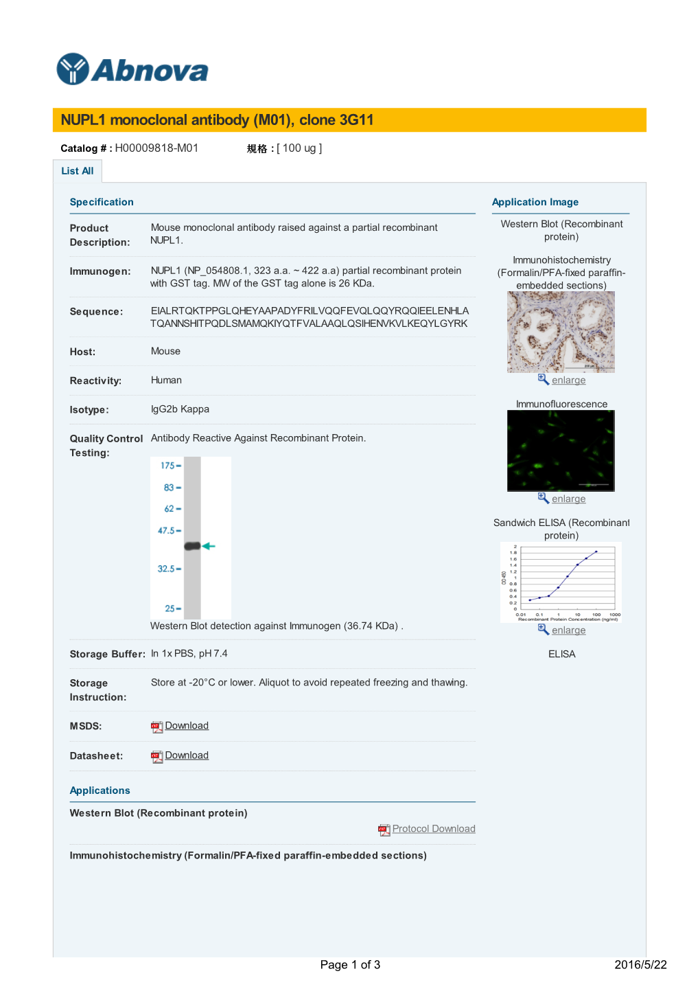 NUPL1 Monoclonal Antibody (M01), Clone 3G11