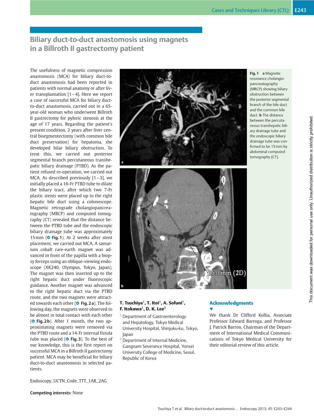 Biliary Duct-To-Duct Anastomosis Using Magnets in a Billroth II Gastrectomy Patient