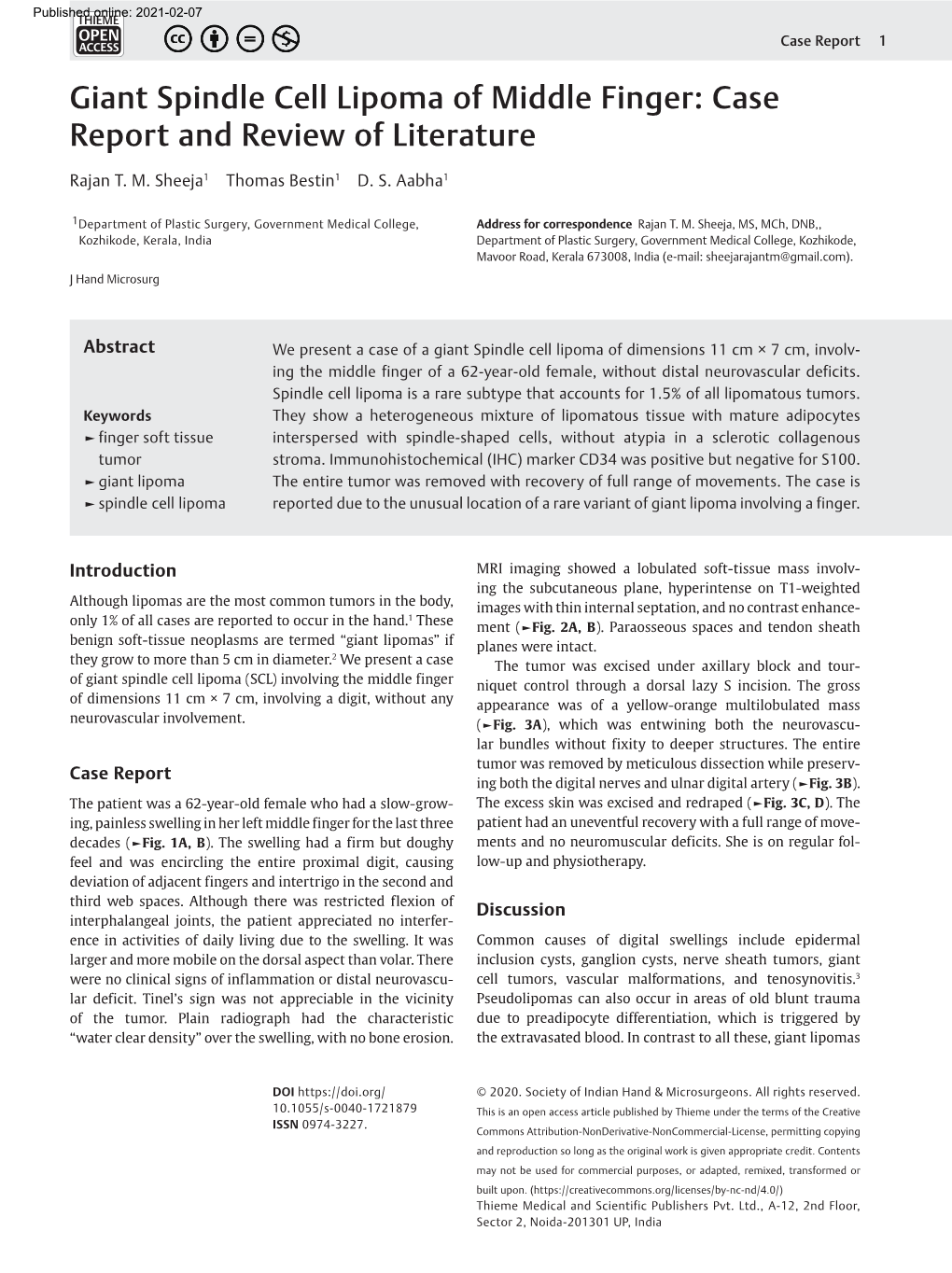 Giant Spindle Cell Lipoma of Middle Finger: Case Report and Review of Literature