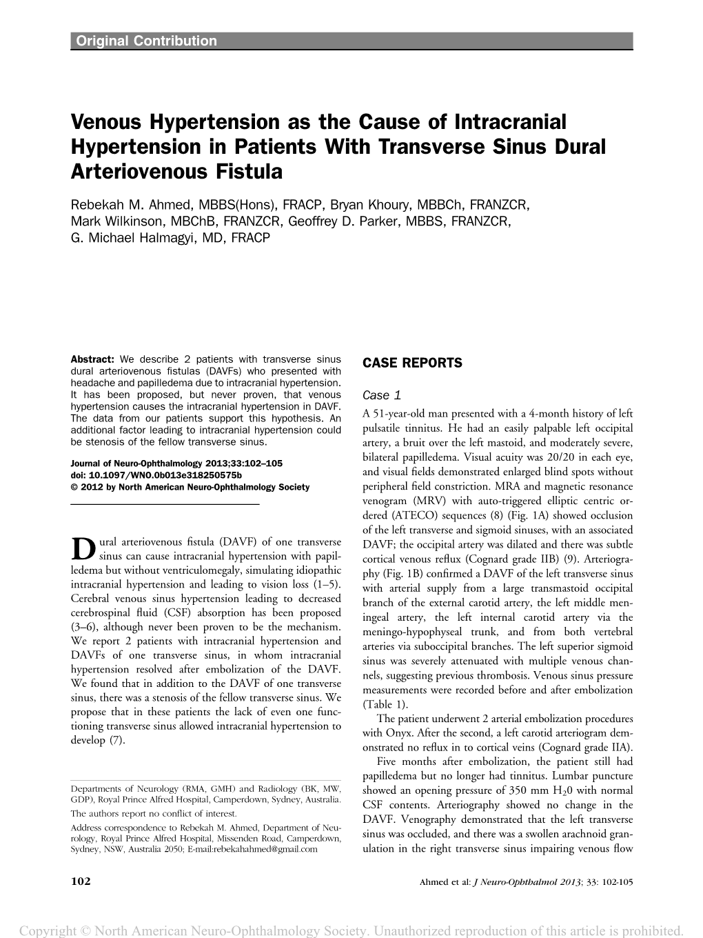 Venous Hypertension As the Cause of Intracranial Hypertension in Patients with Transverse Sinus Dural Arteriovenous Fistula